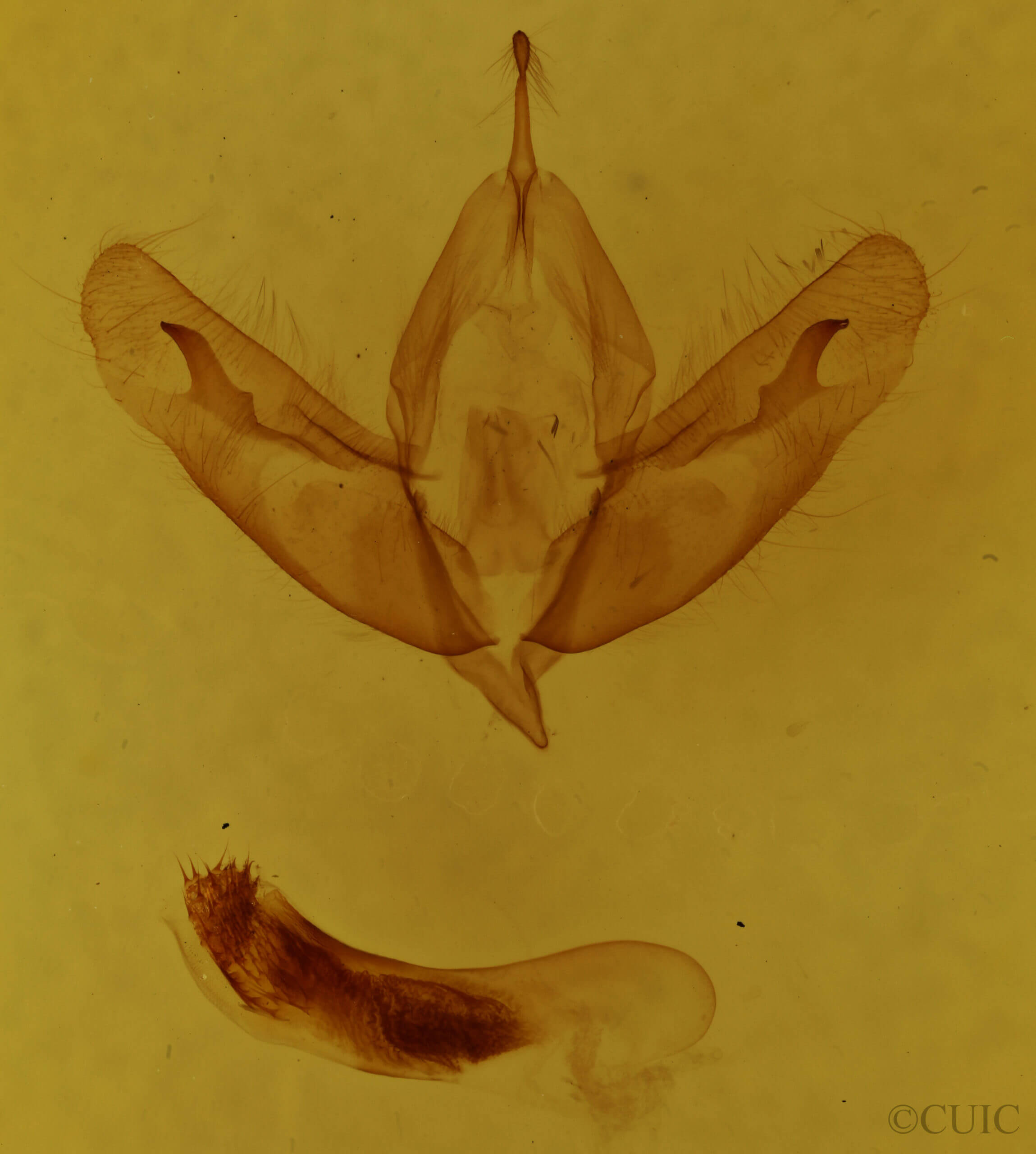 genitalia view of adult Acronicta ovata