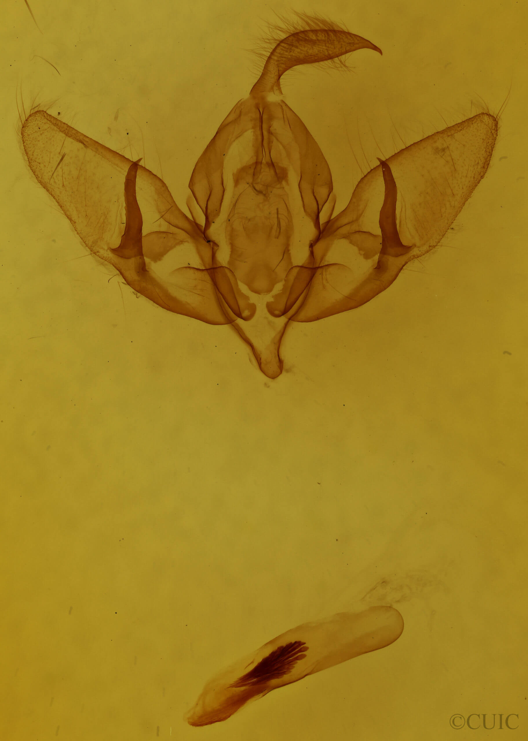 genitalia view of adult Acronicta lepusculina lepusculina