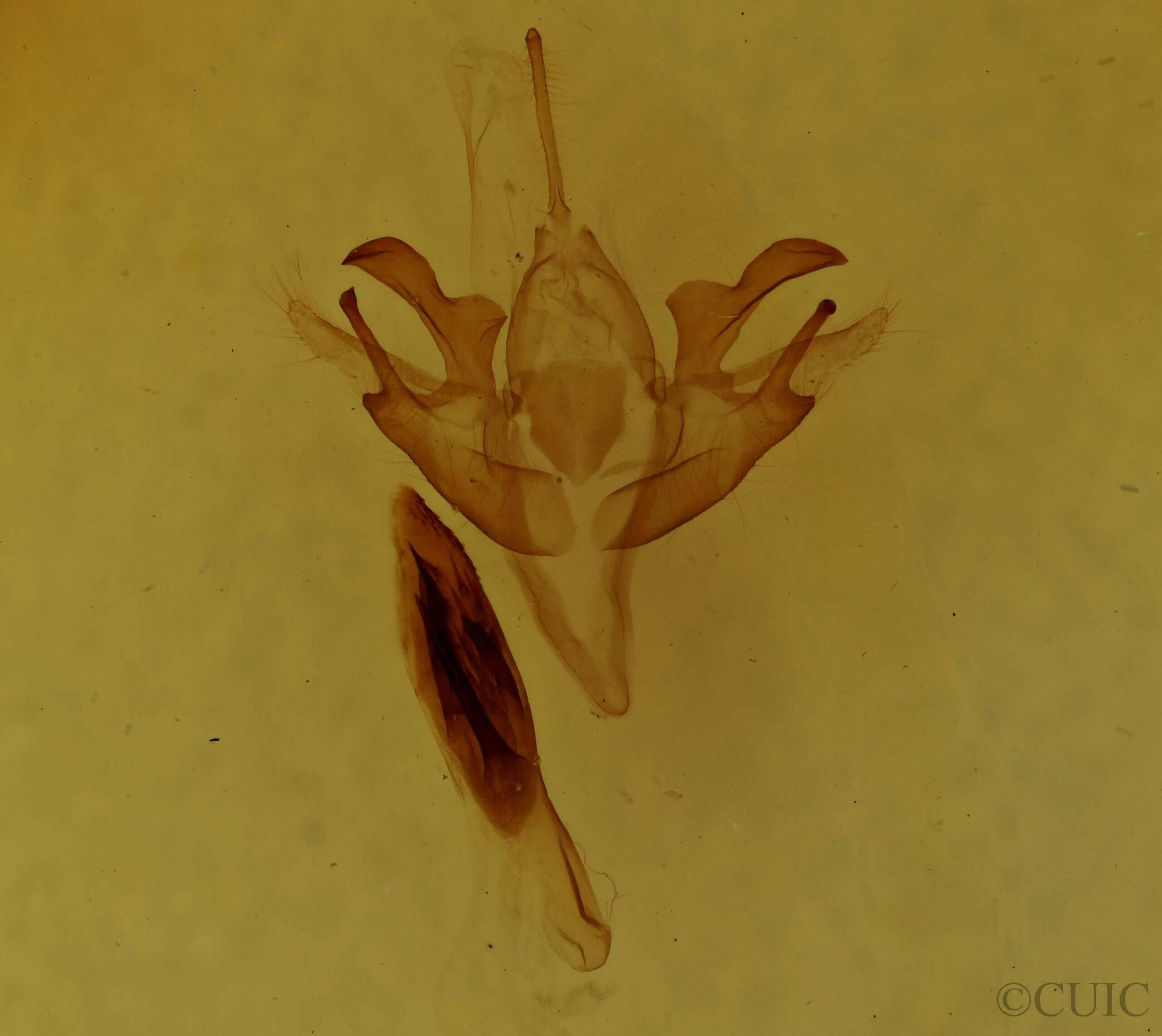 genitalia view of adult Acronicta retardata