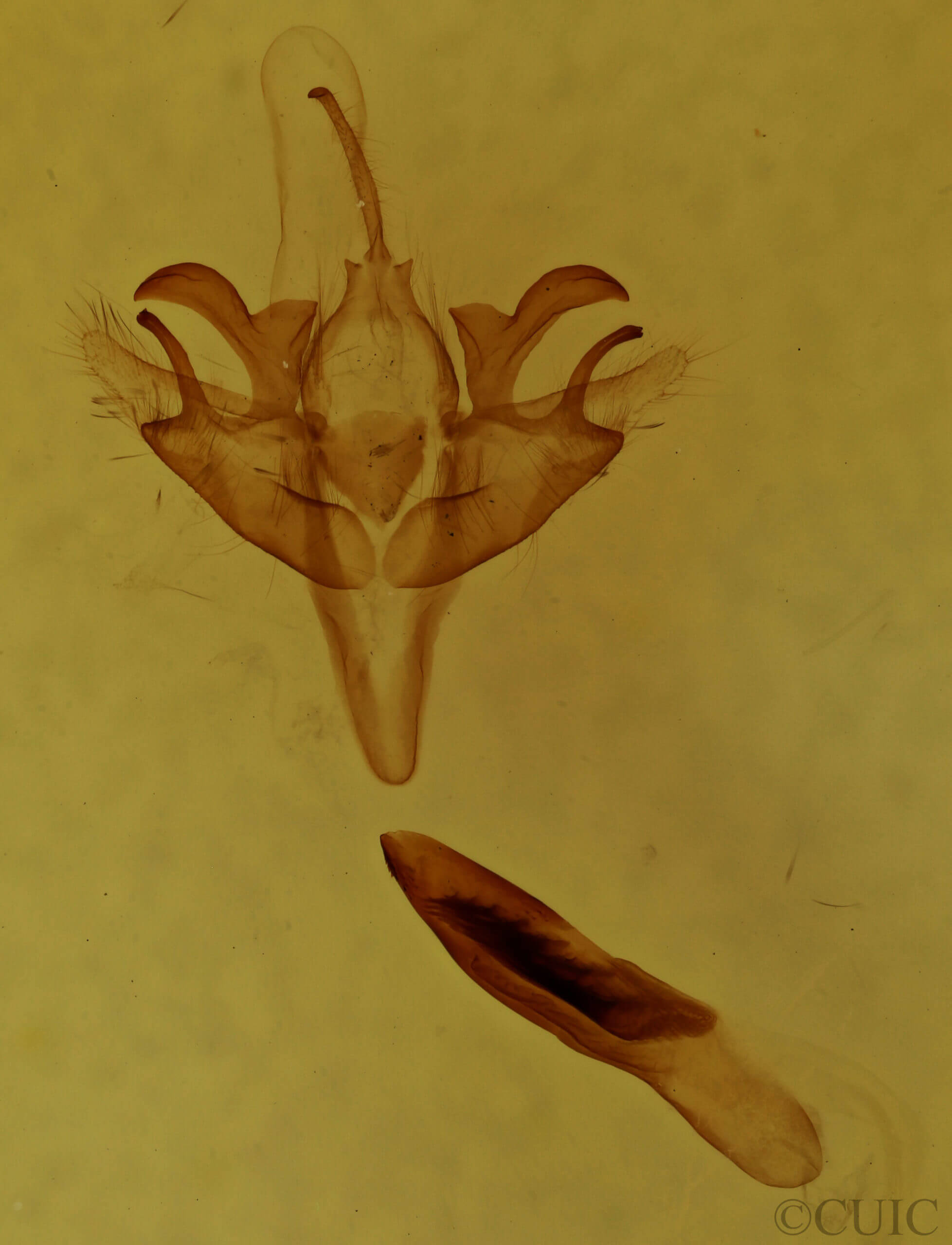 genitalia view of adult Acronicta retardata