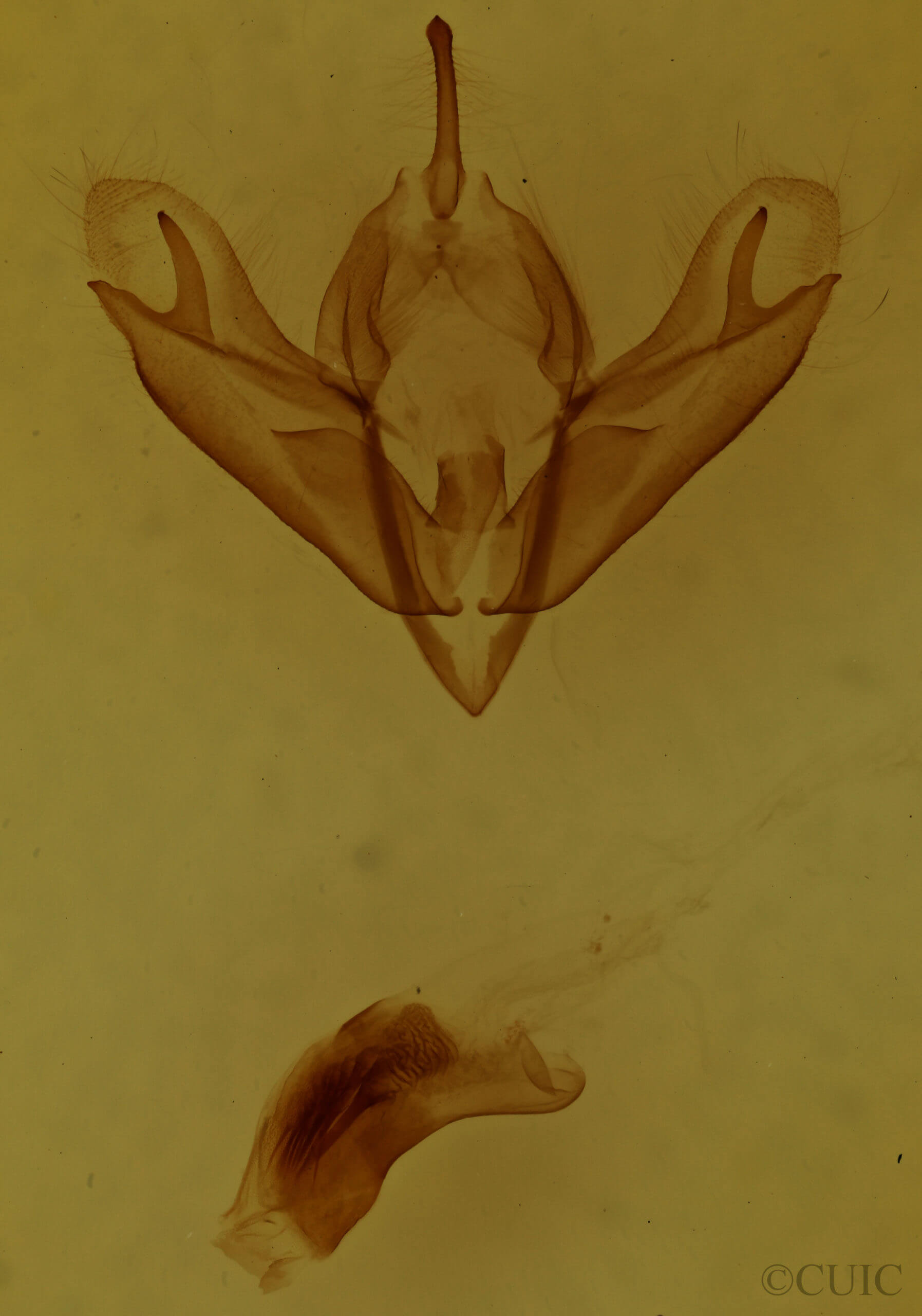 genitalia view of adult Acronicta sperata