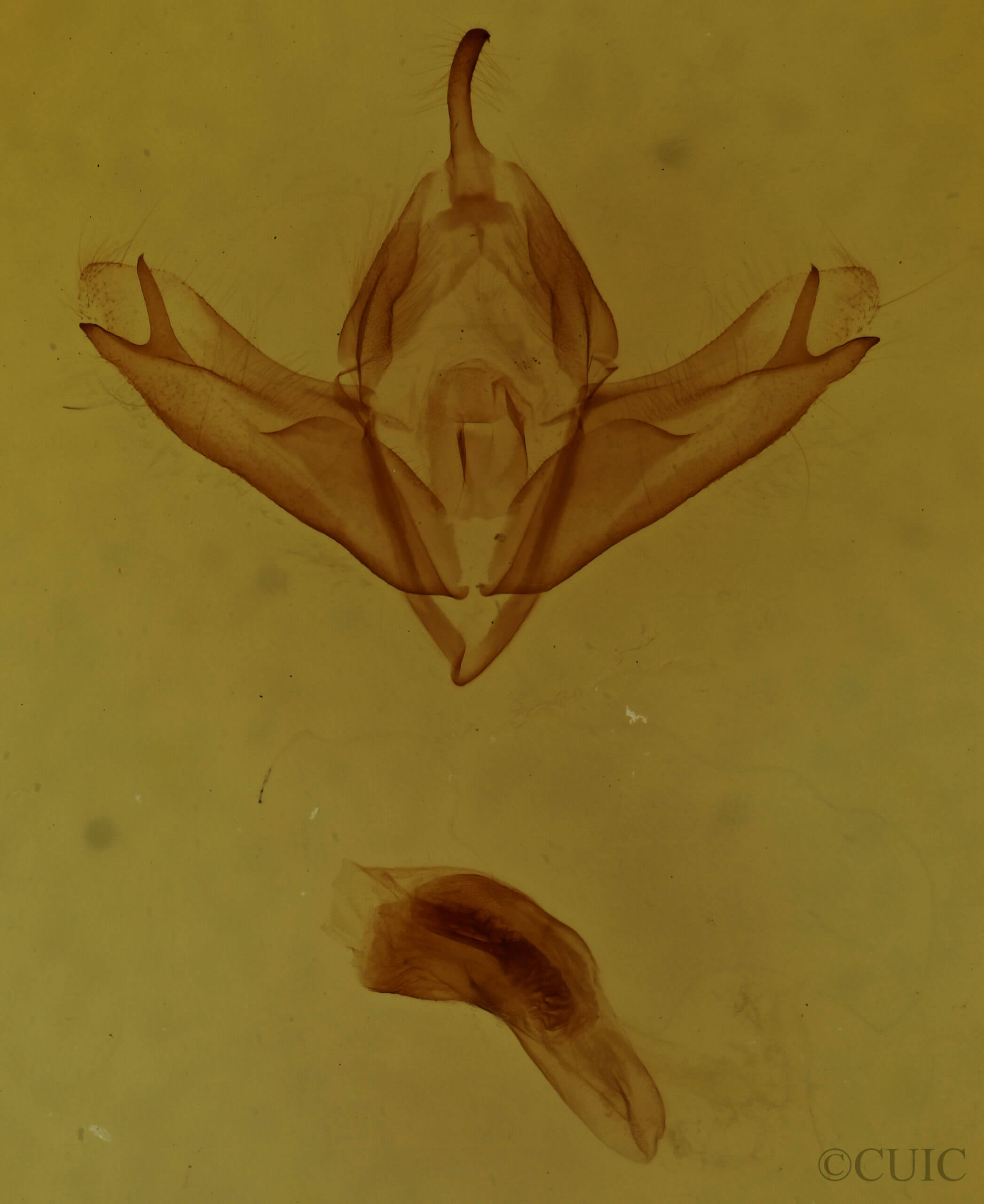 genitalia view of adult Acronicta sperata