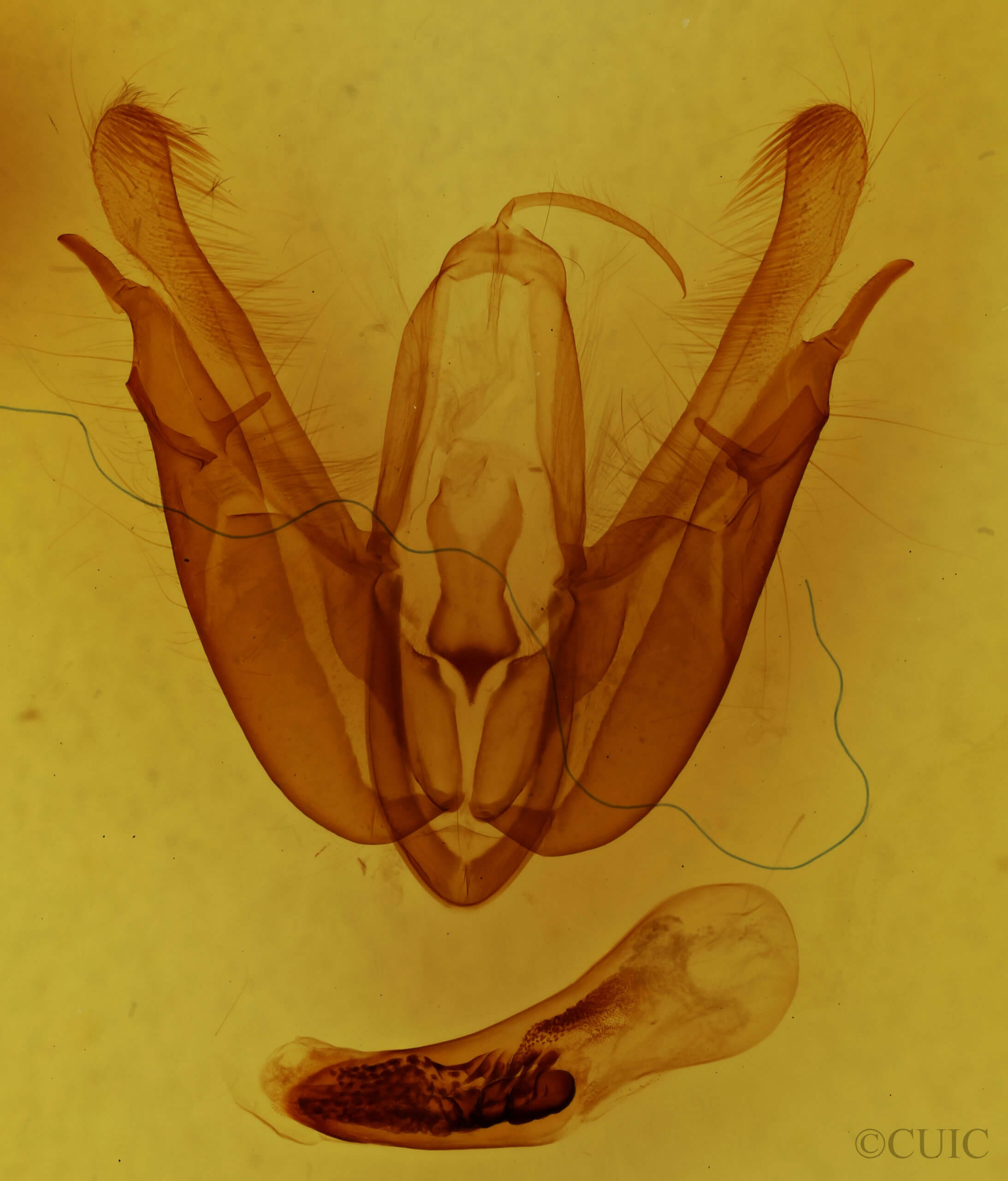genitalia view of adult Acronicta superans