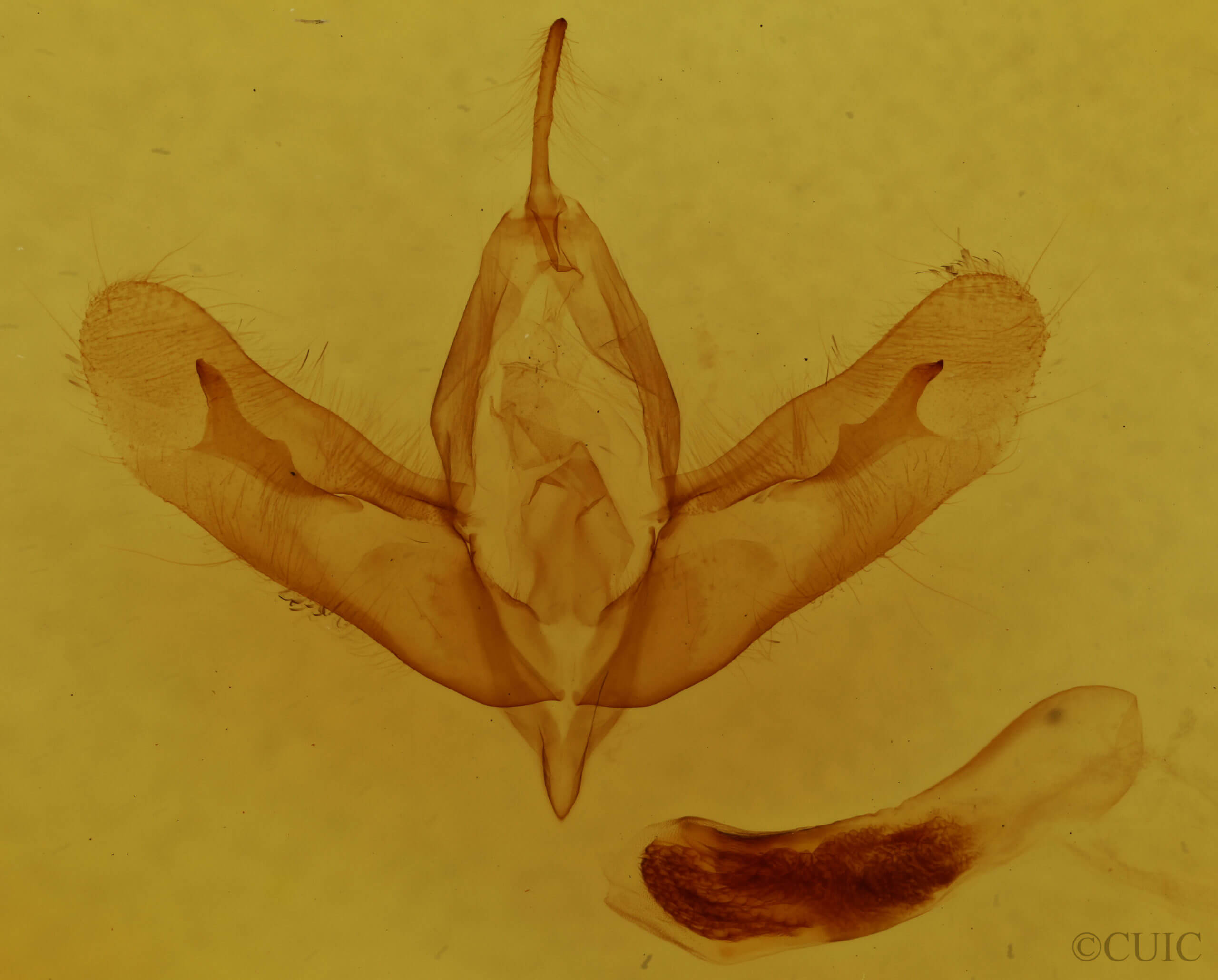 genitalia view of adult Acronicta tristis