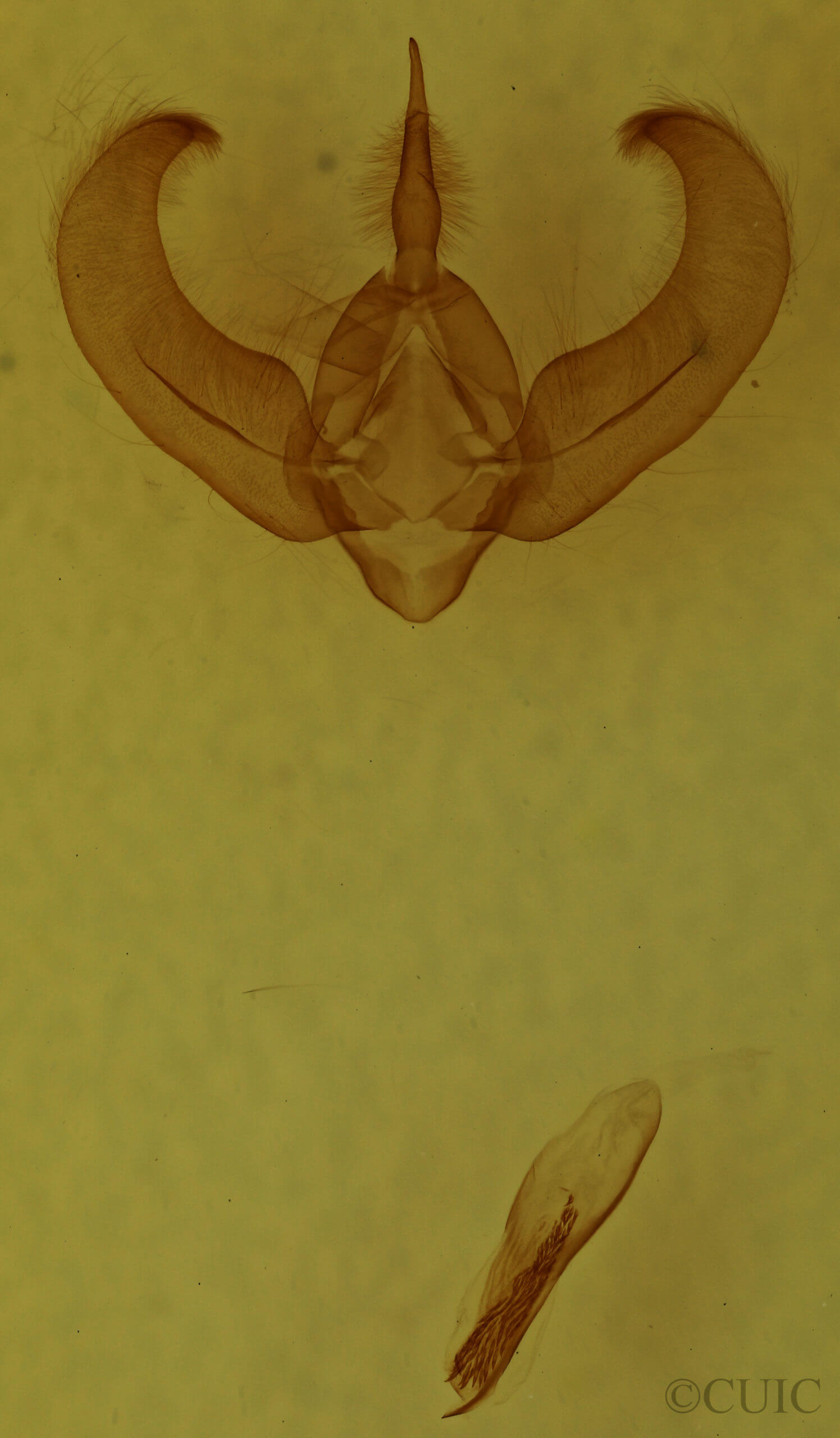 genitalia view of adult Amphipyra glabella