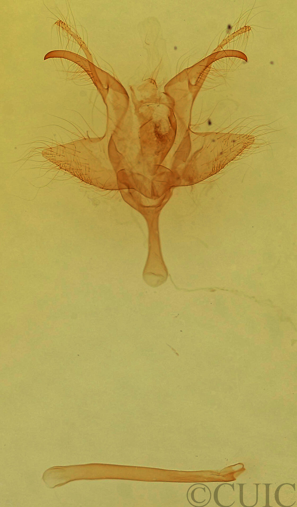 genitalia view of adult Anticla
