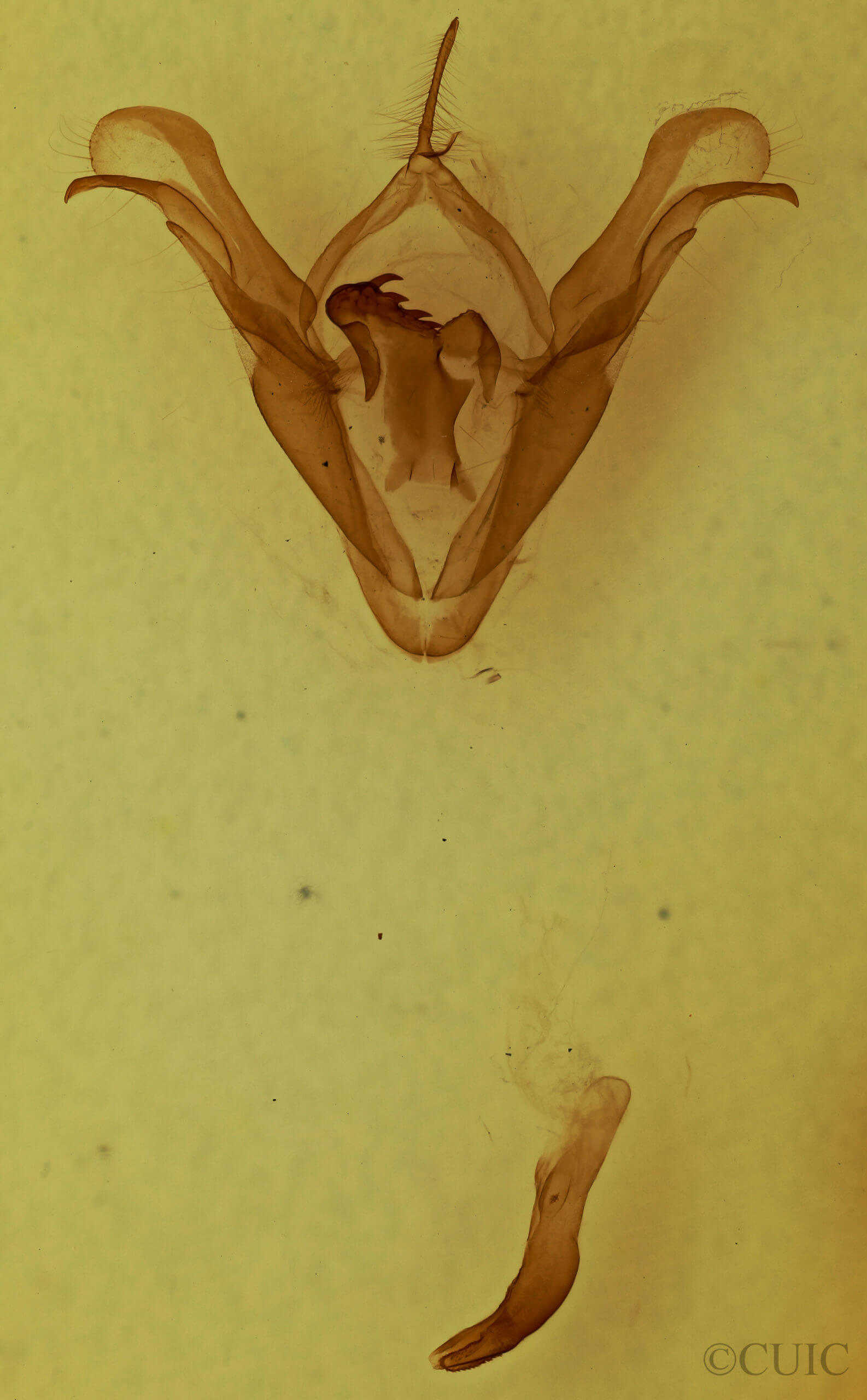 genitalia view of adult Celiptera frustulum