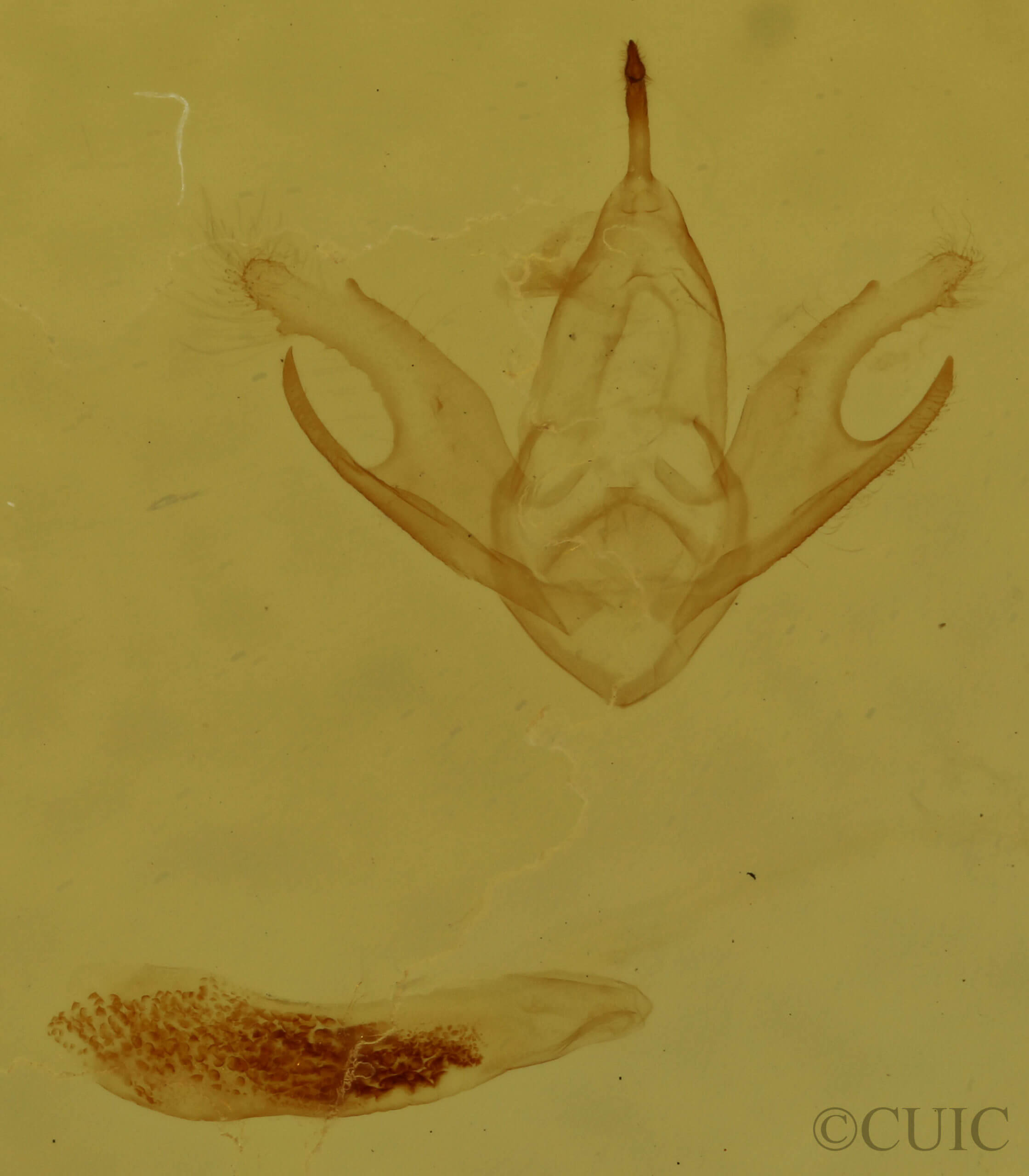 genitalia view of adult Chytolita morbidalis