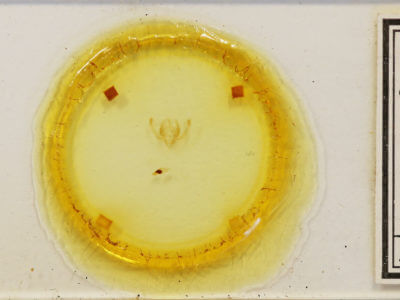 slide view of adult Chytonix albonotata