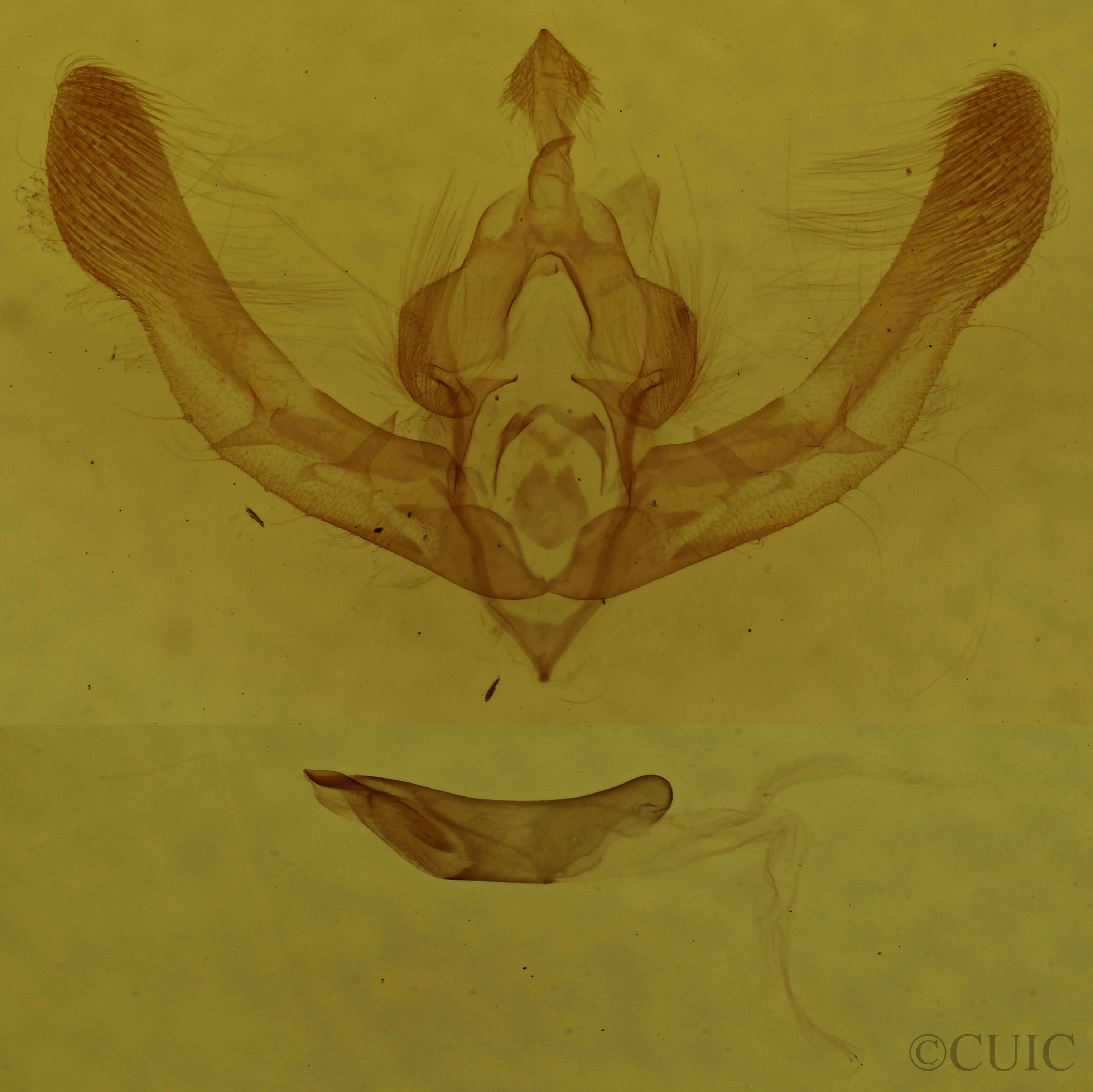 genitalia view of adult Chytonix palliatricula