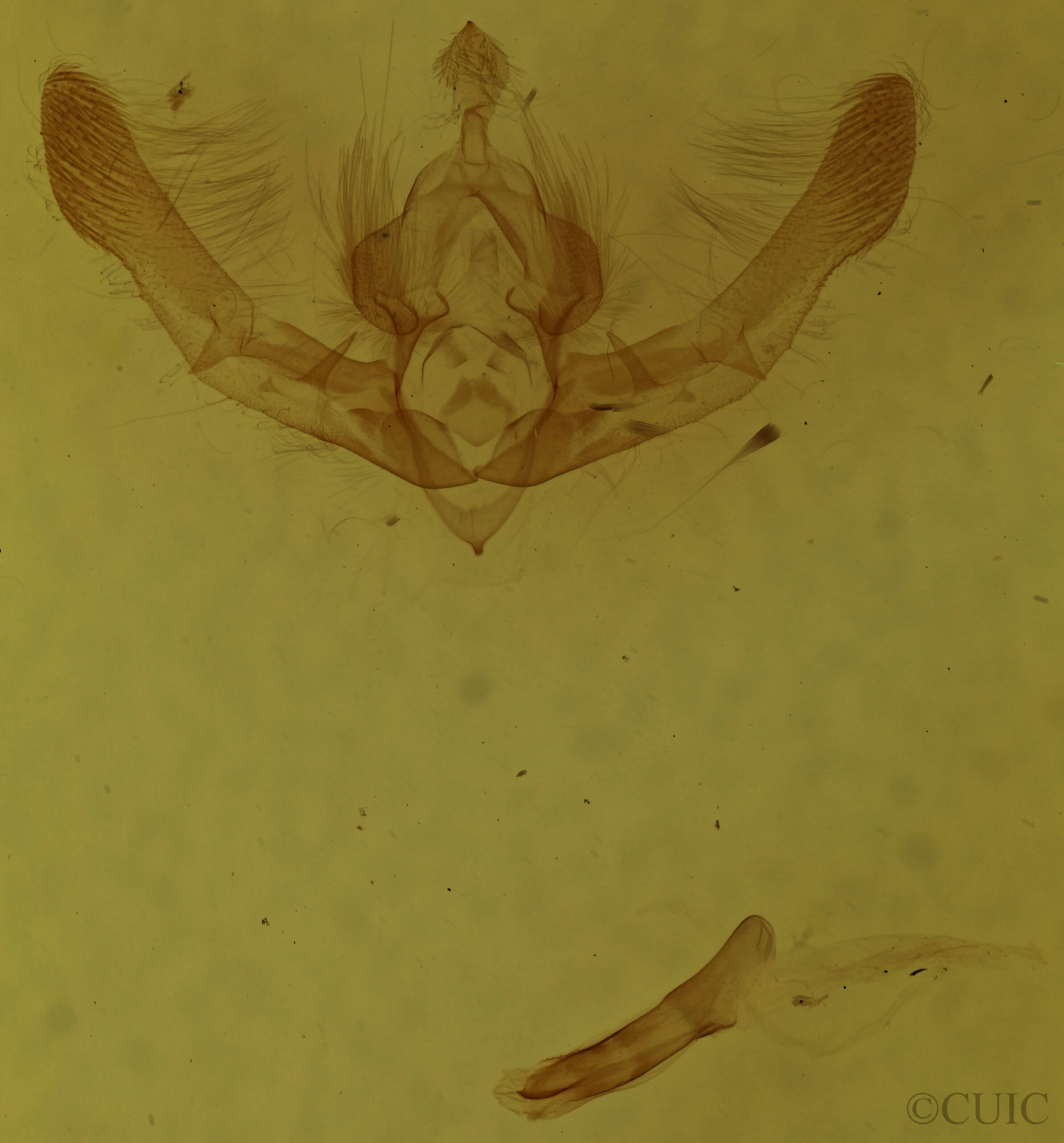 genitalia view of adult Chytonix palliatricula
