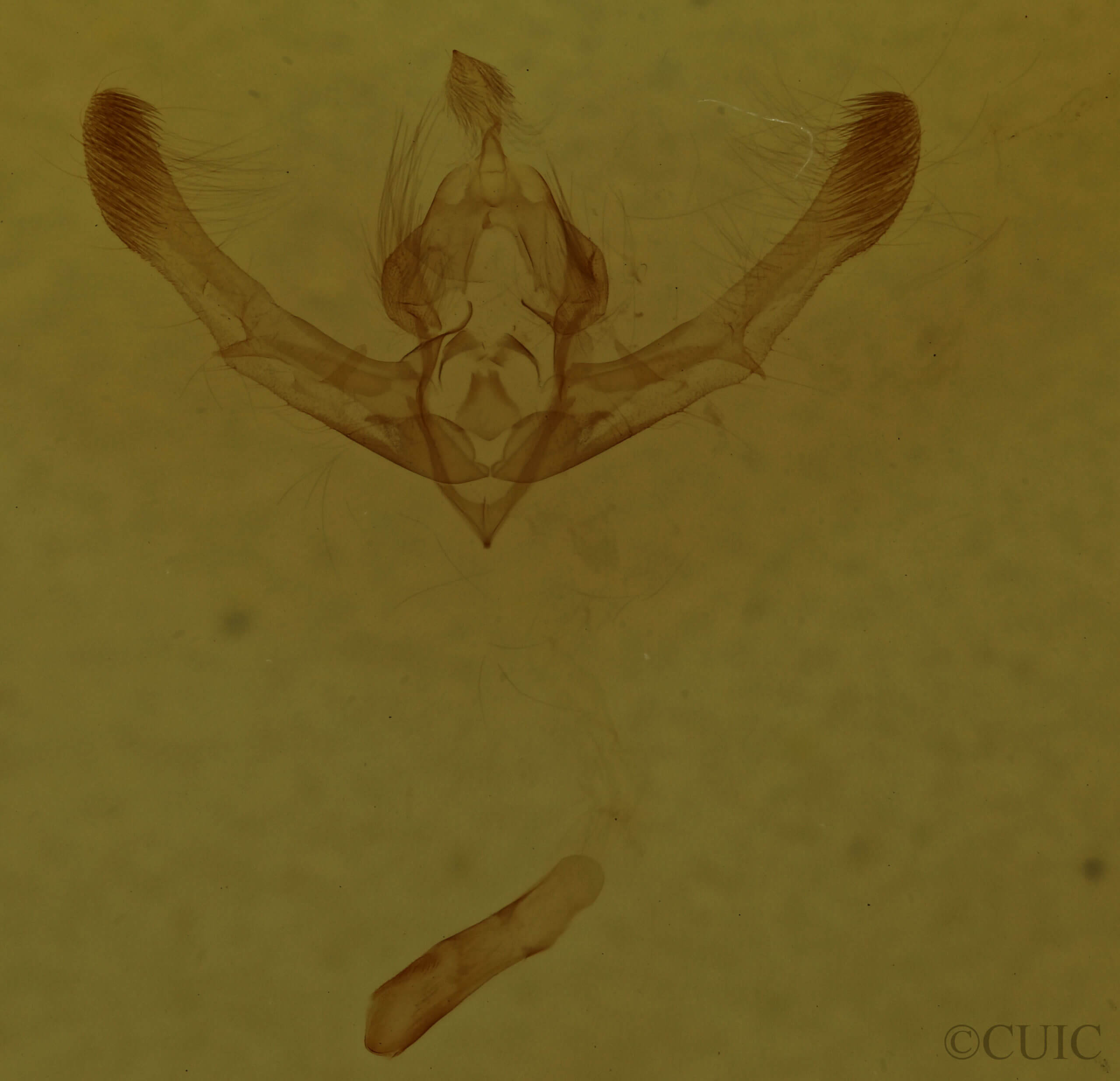 genitalia view of adult Chytonix palliatricula