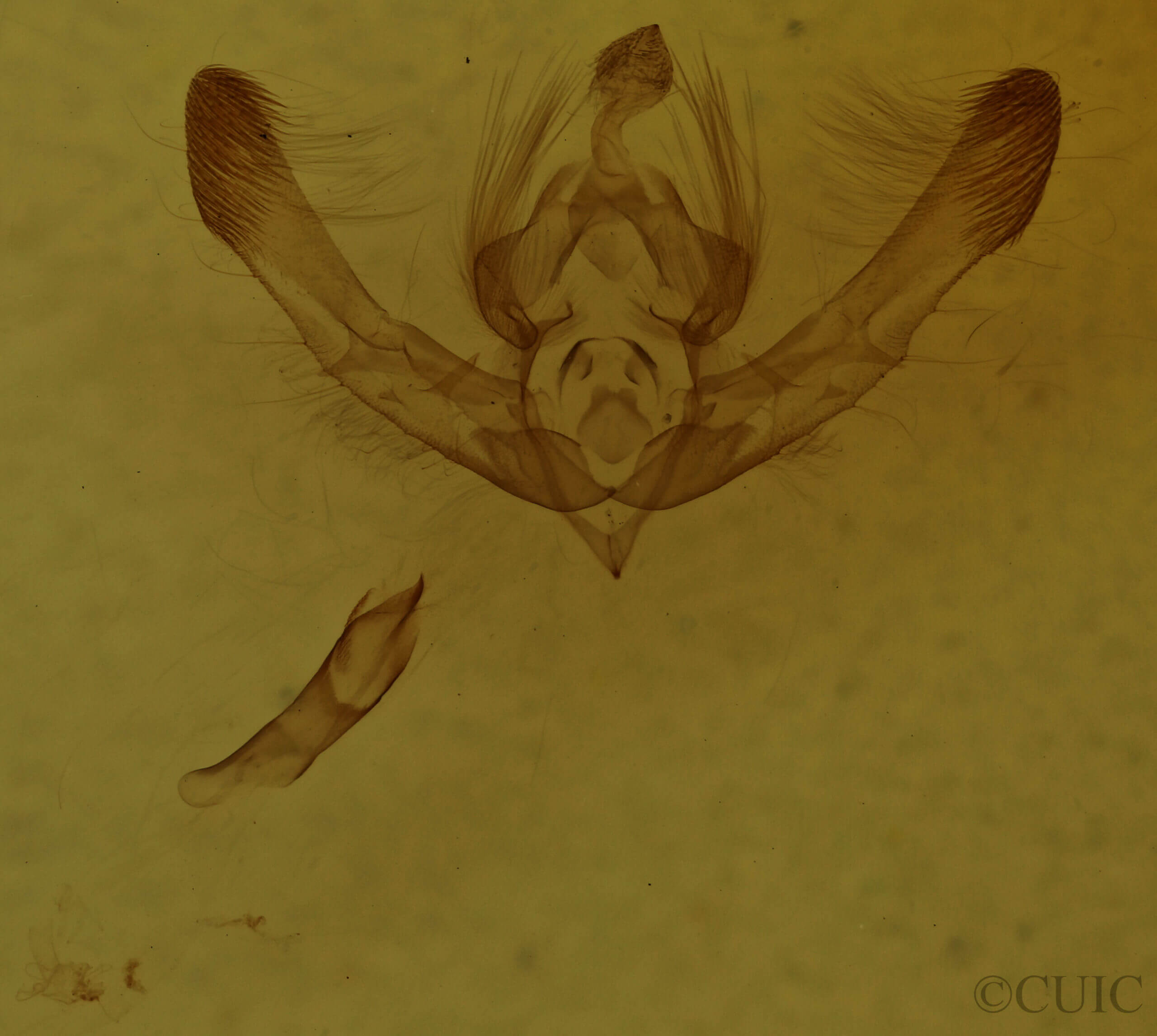 genitalia view of adult Chytonix palliatricula