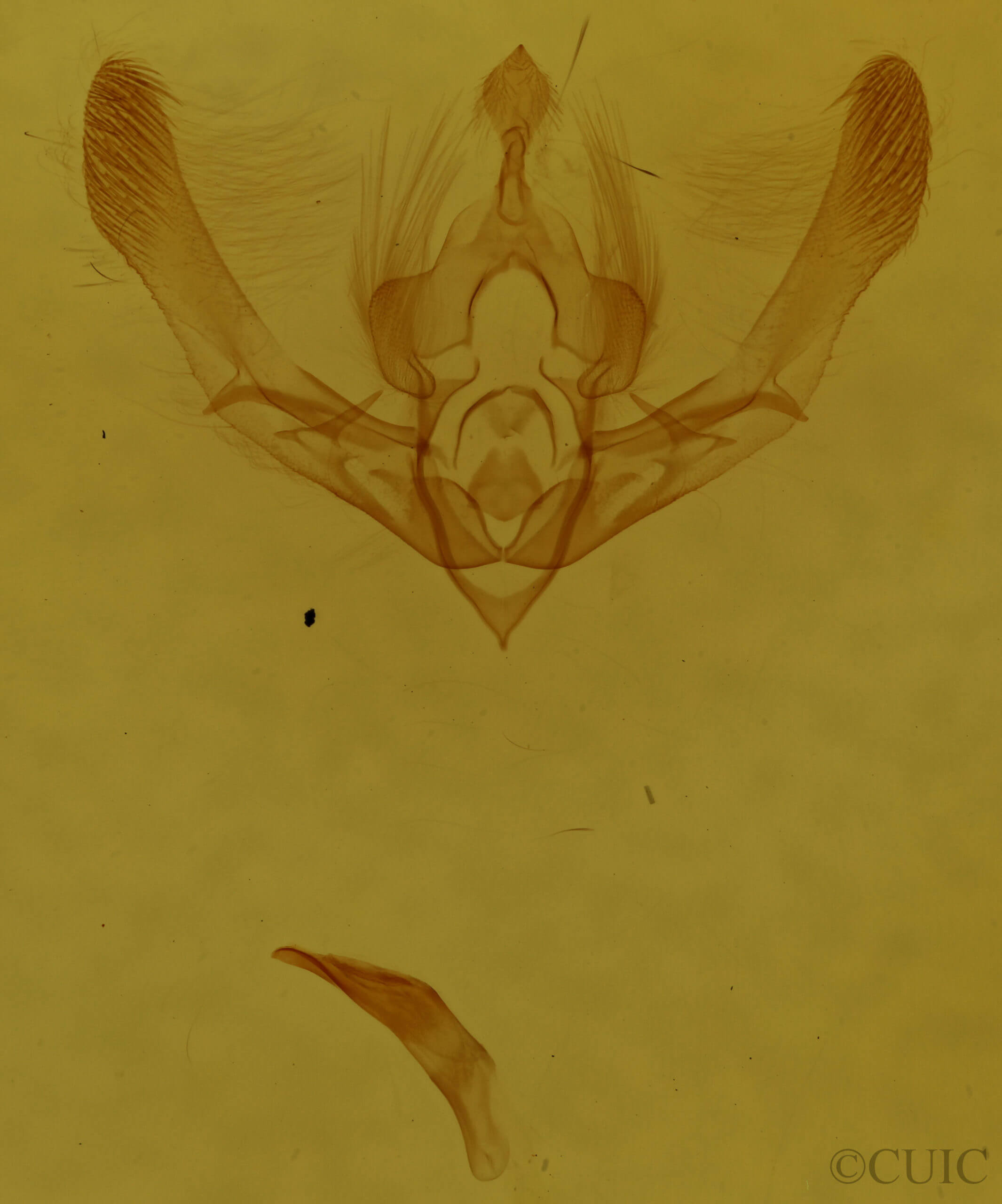 genitalia view of adult Chytonix palliatricula