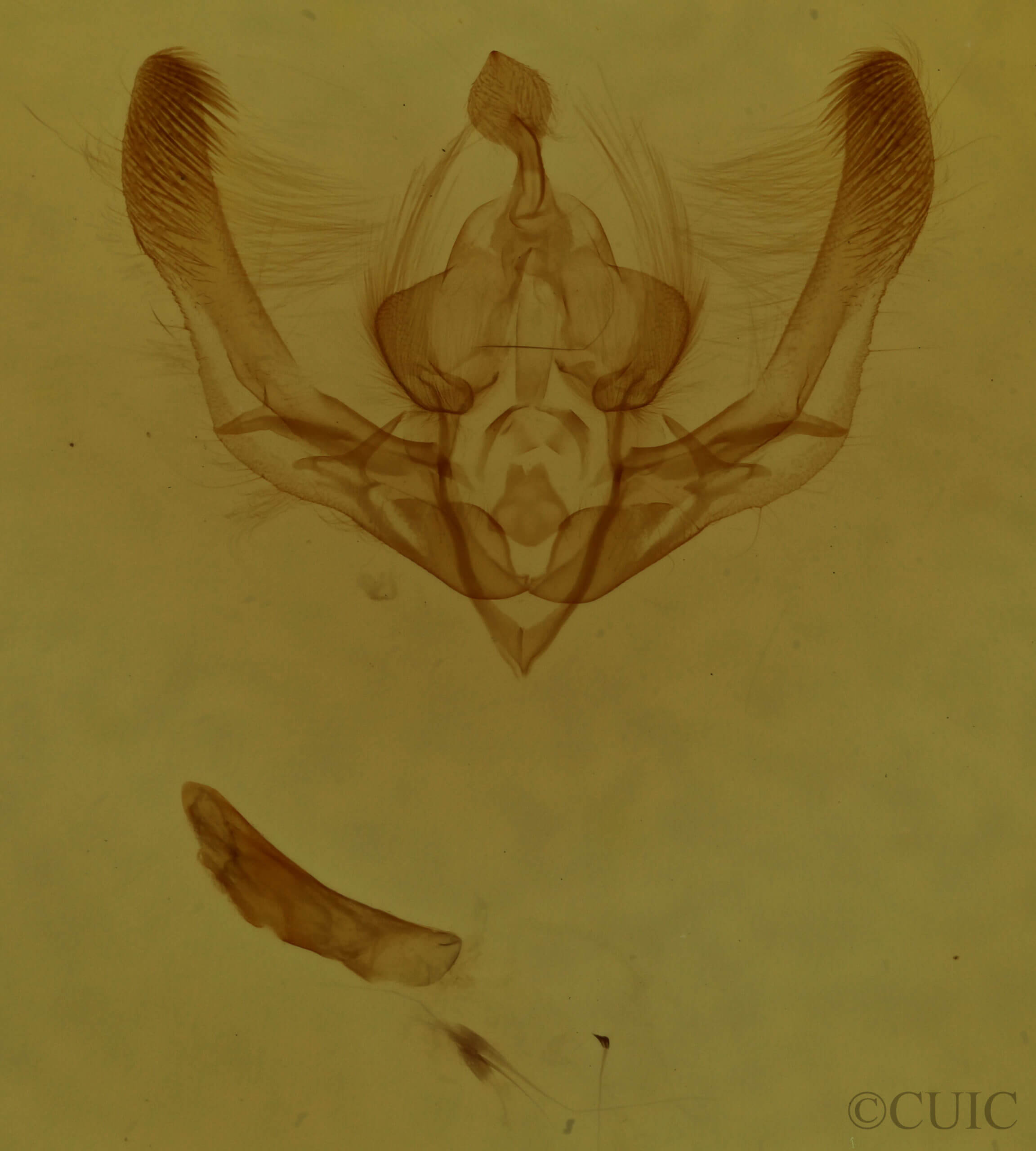 genitalia view of adult Chytonix palliatricula