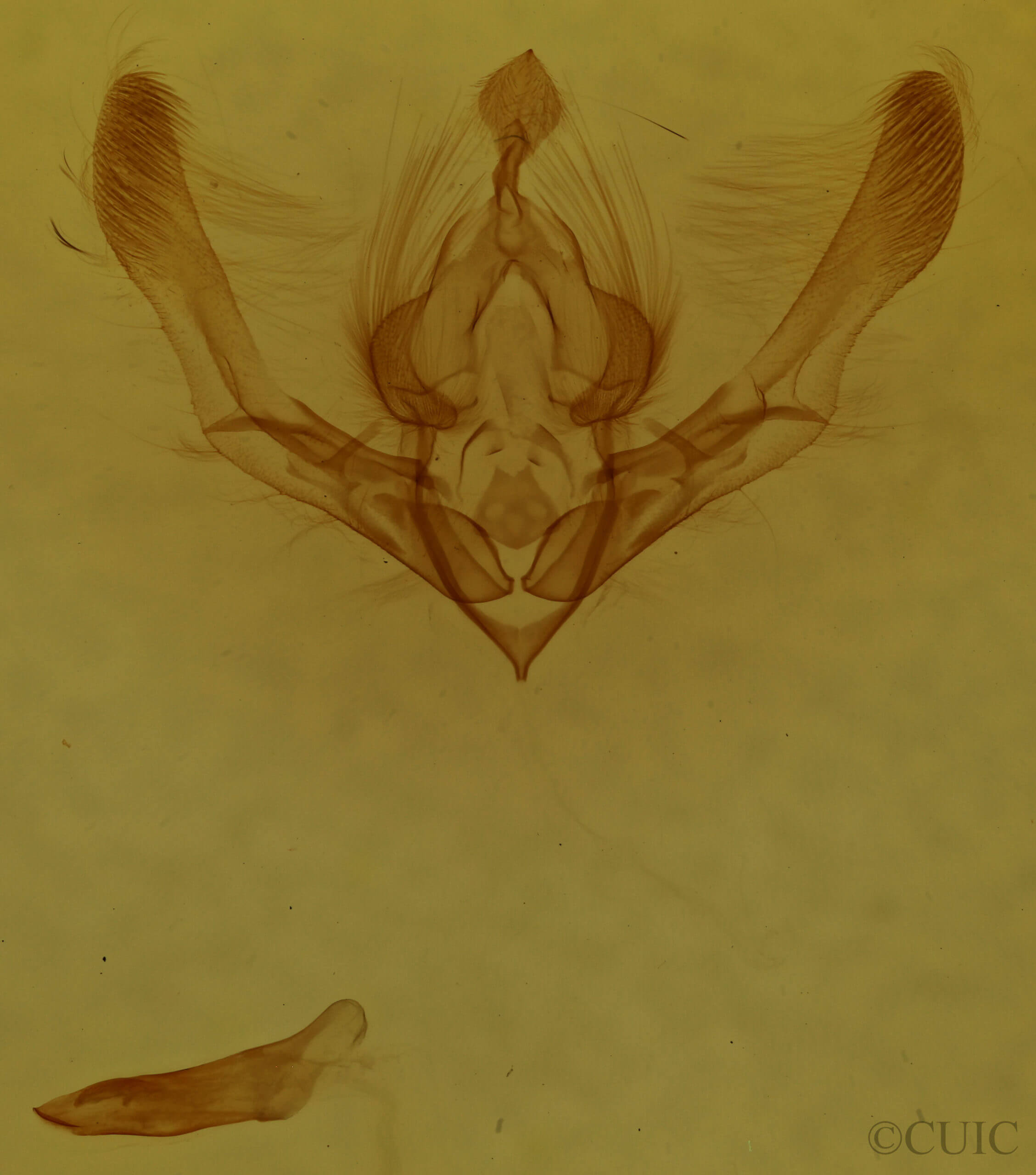 genitalia view of adult Chytonix palliatricula