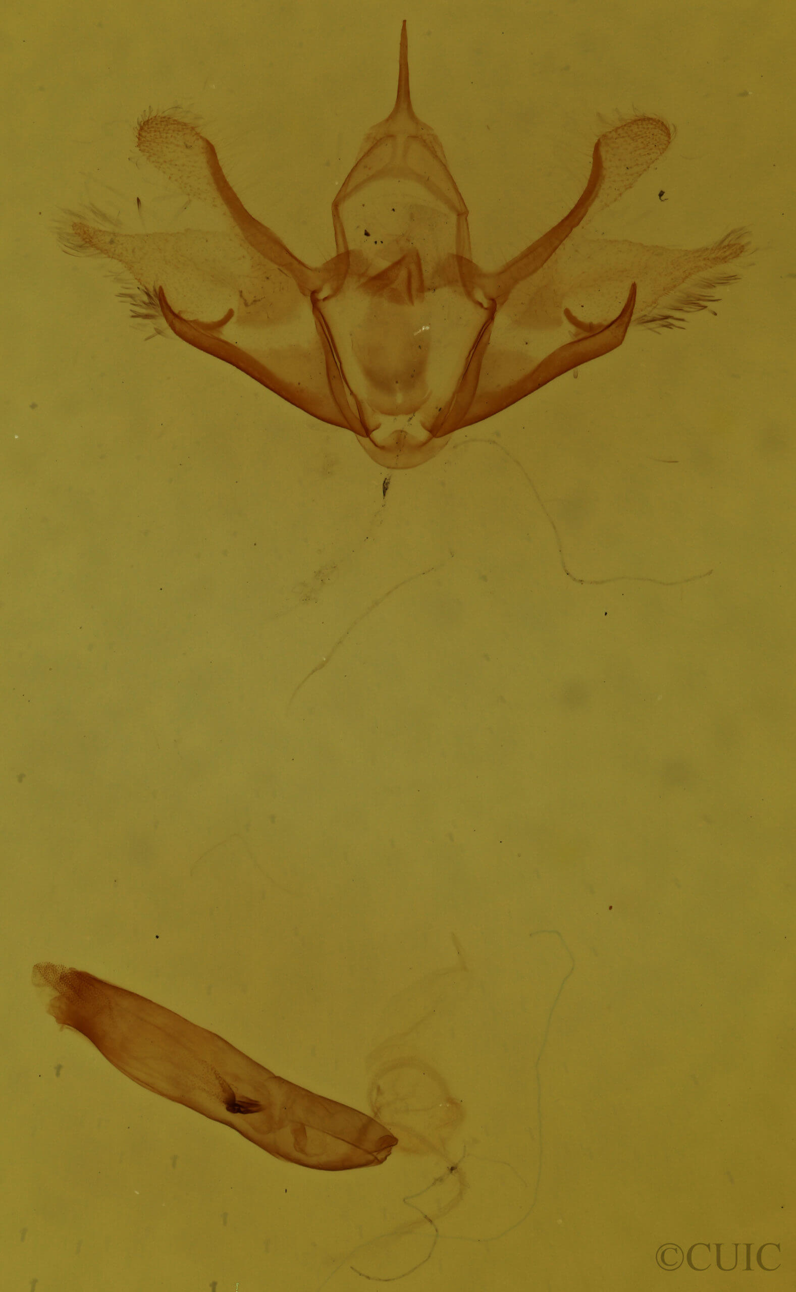 genitalia view of adult Cladara atroliturata