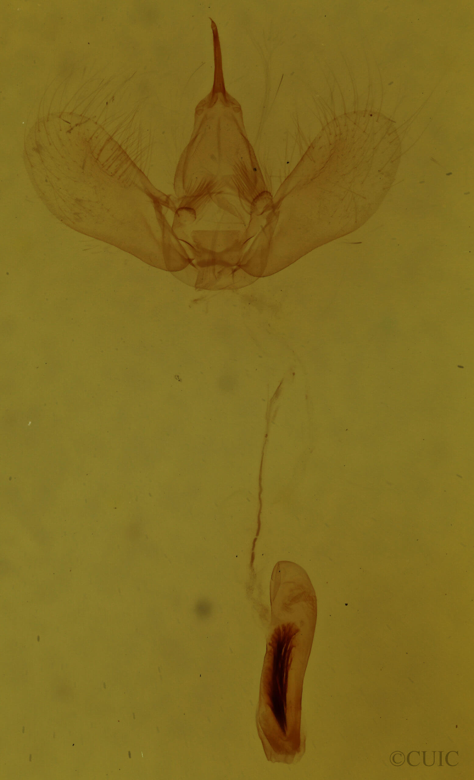 genitalia view of adult Dysstroma