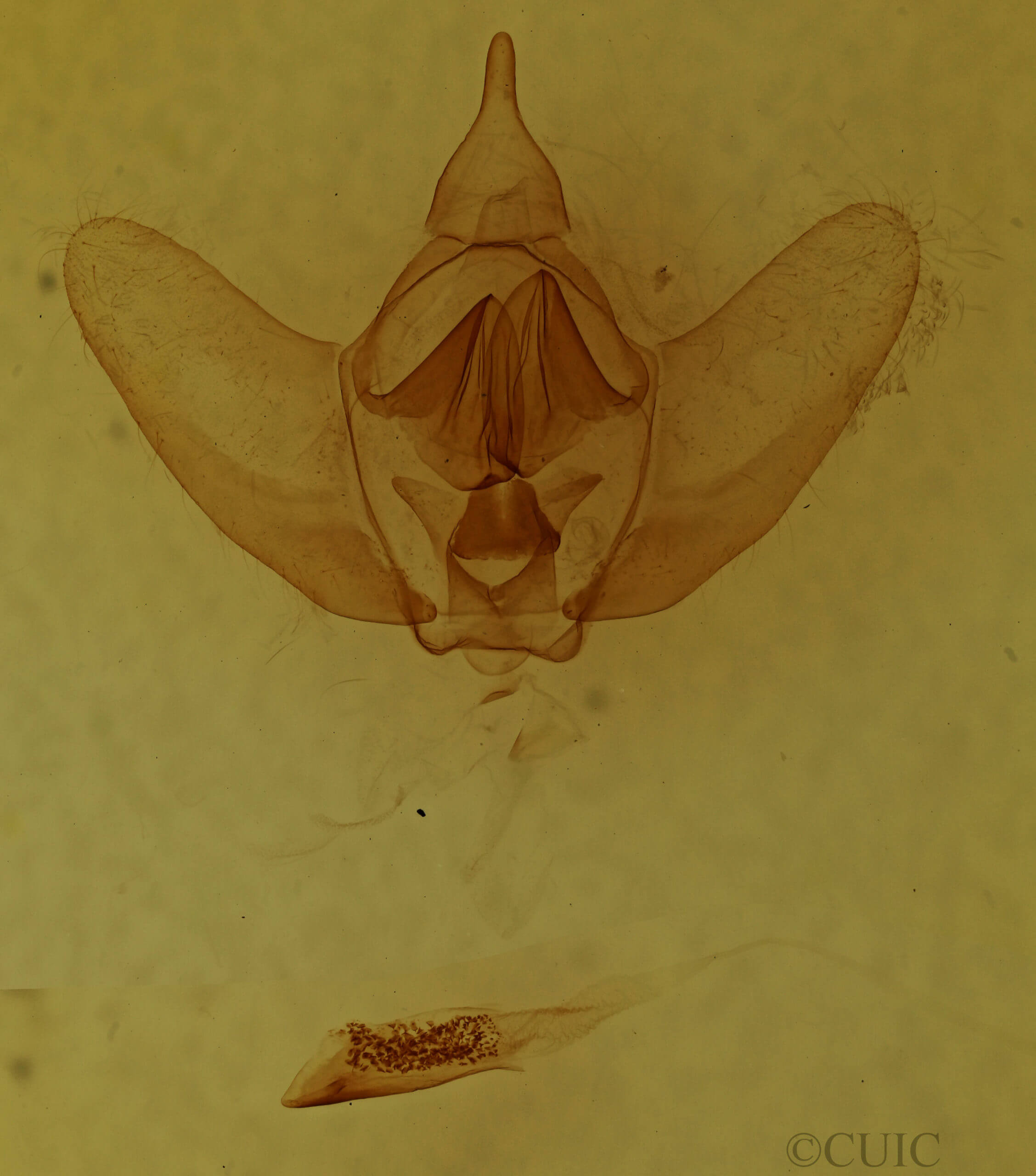 genitalia view of adult Eadmuna esperans