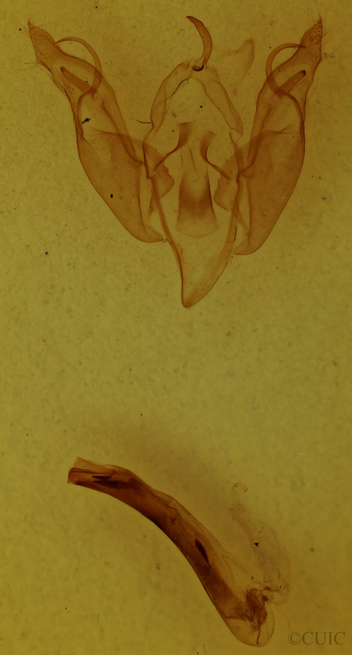 genitalia view of adult Egira simplex