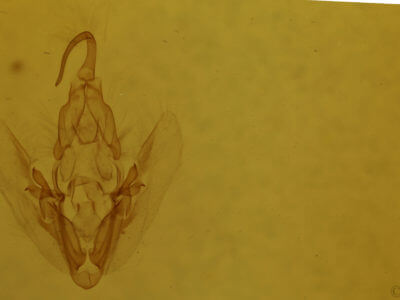 genitalia view of adult Elaphria versicolor