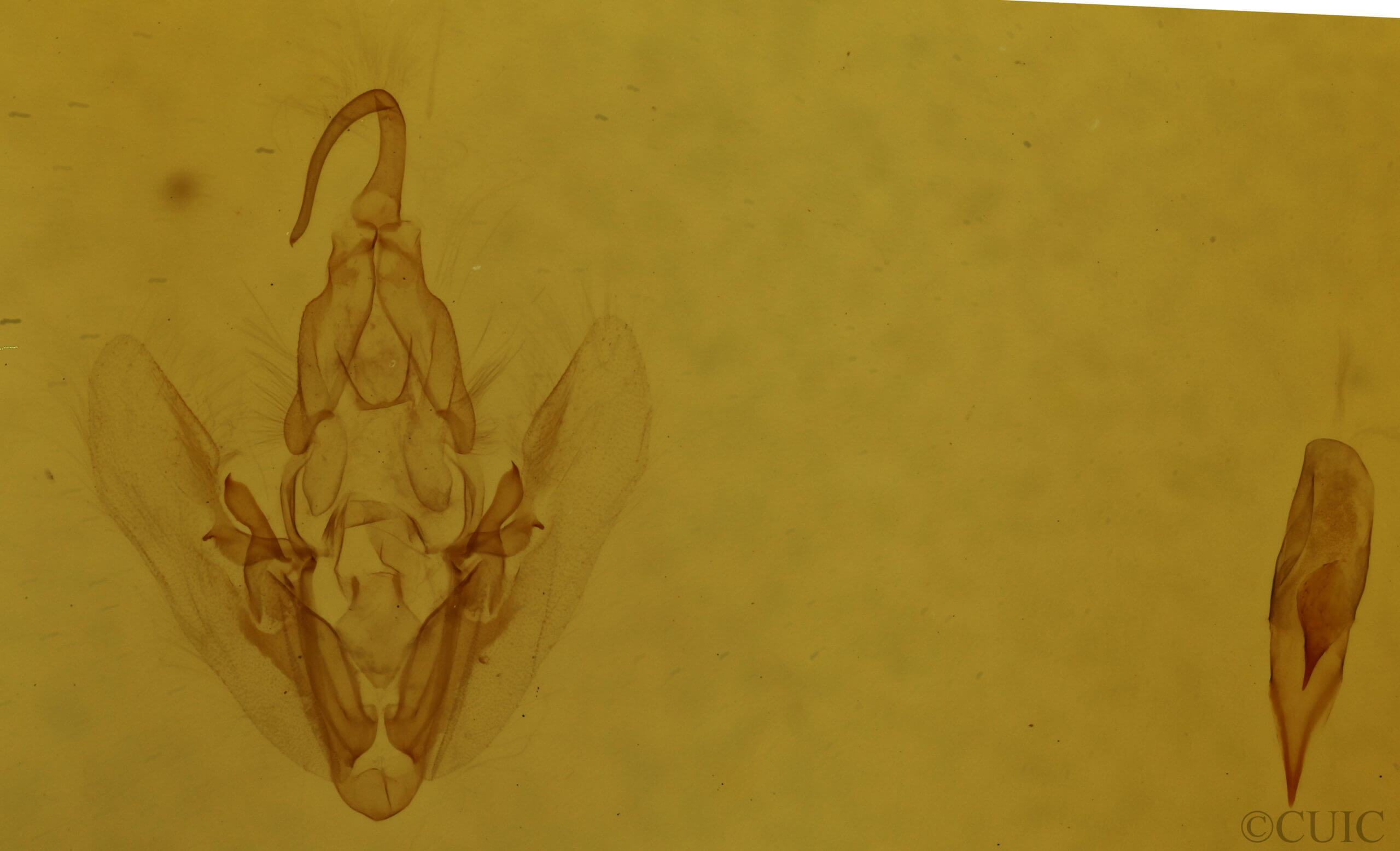 genitalia view of adult Elaphria versicolor