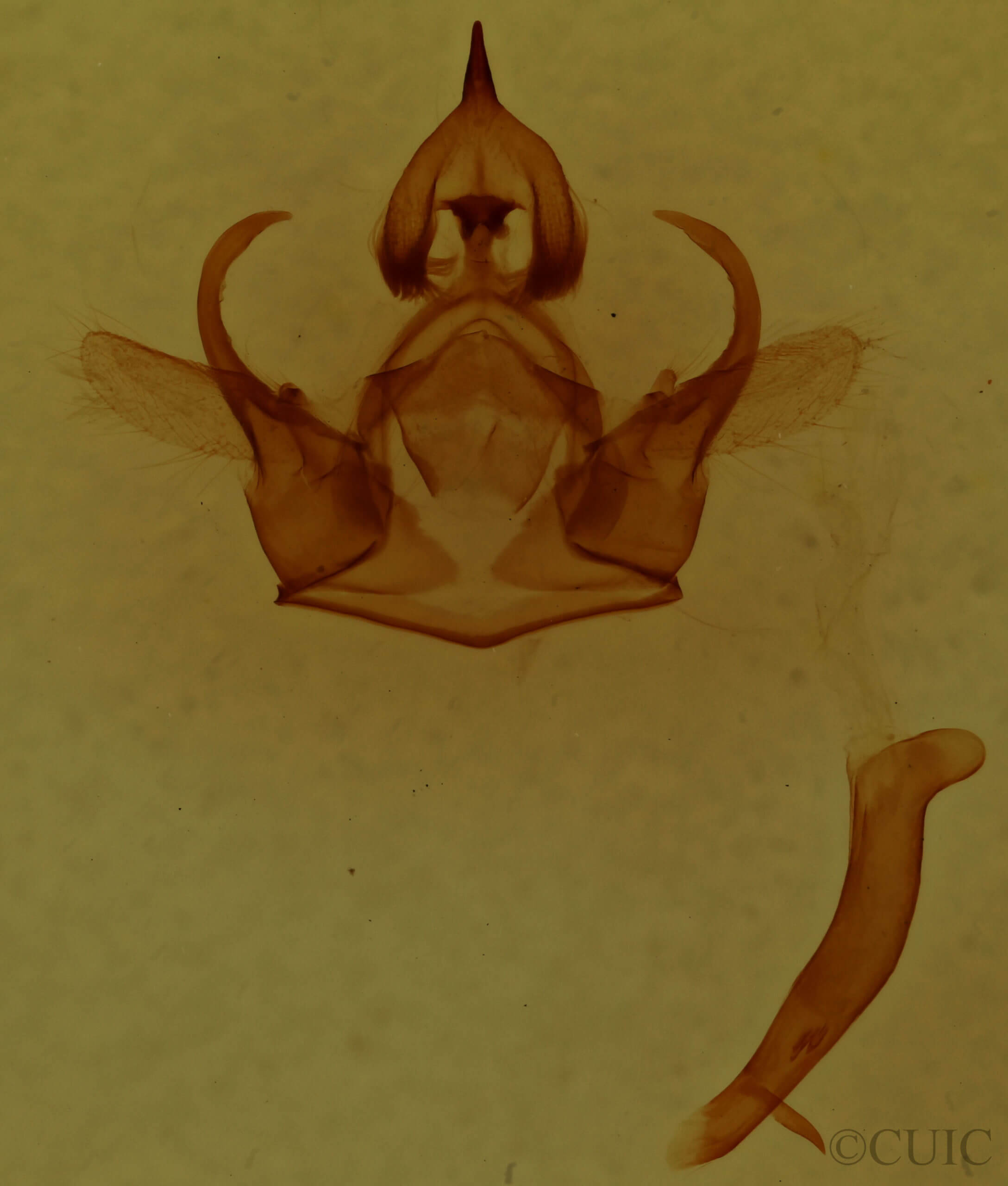 genitalia view of adult Euchaetes egle