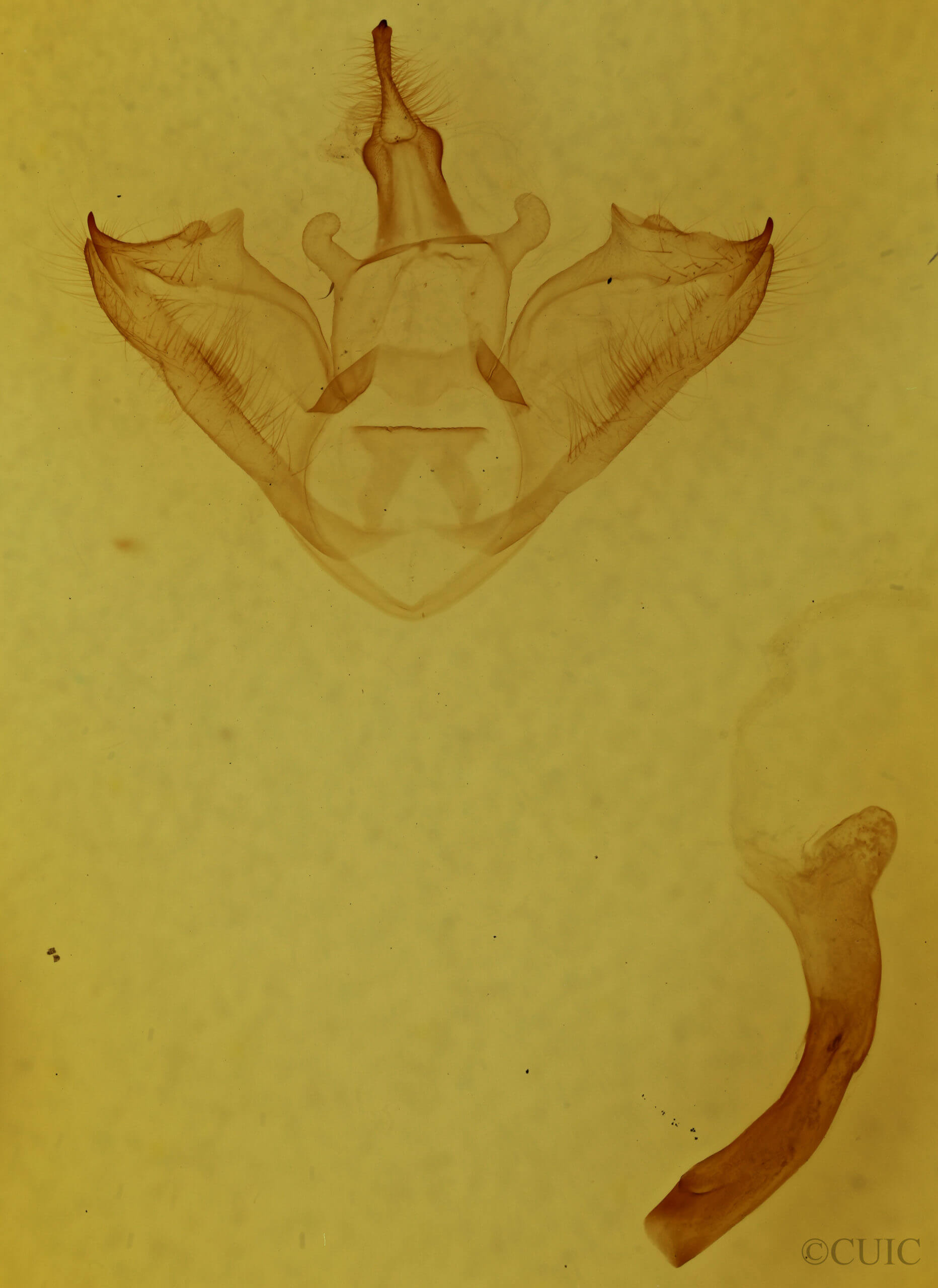 genitalia view of adult Halysidota tessellaris