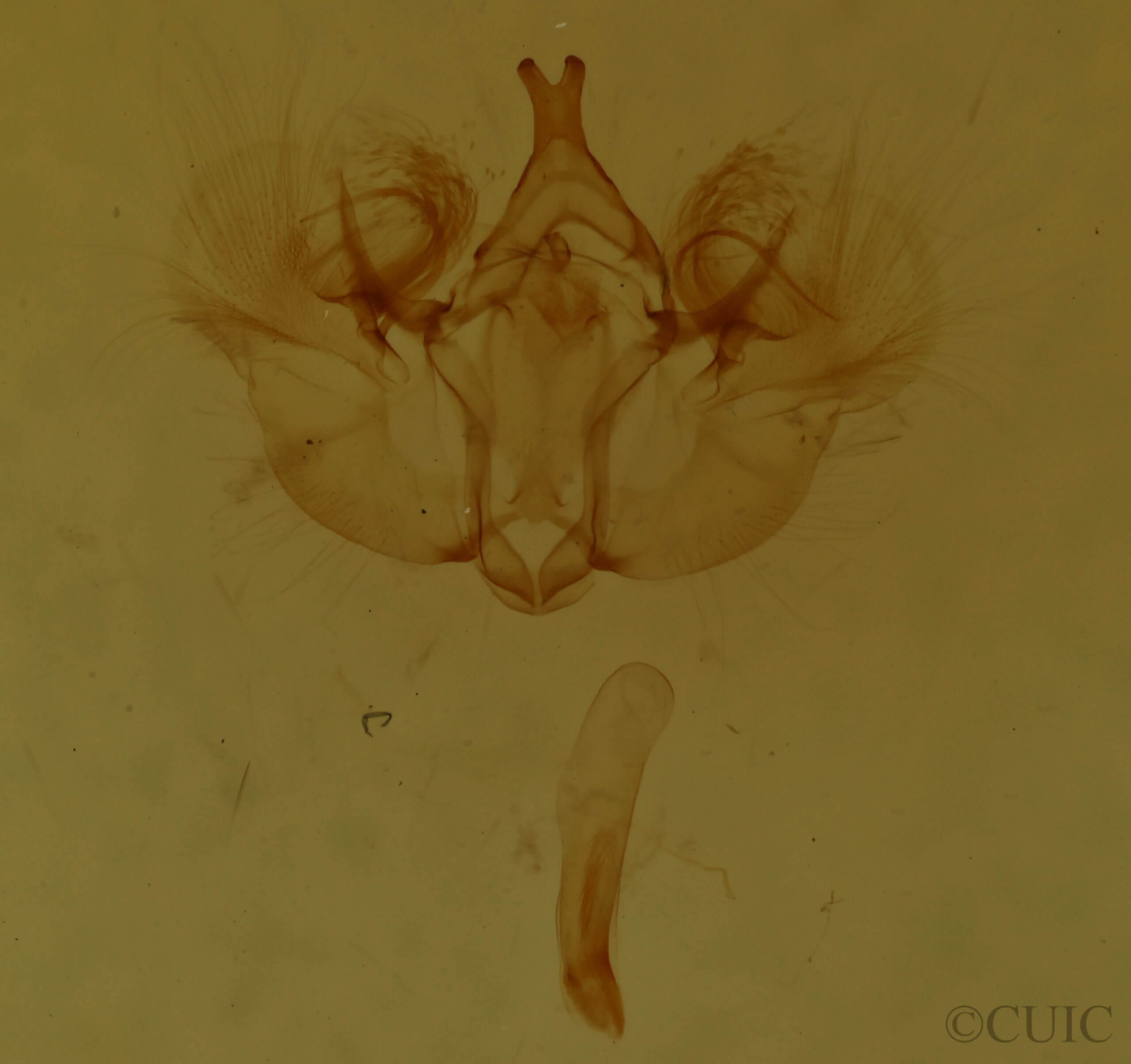 genitalia view of adult Hydriomena divisaria