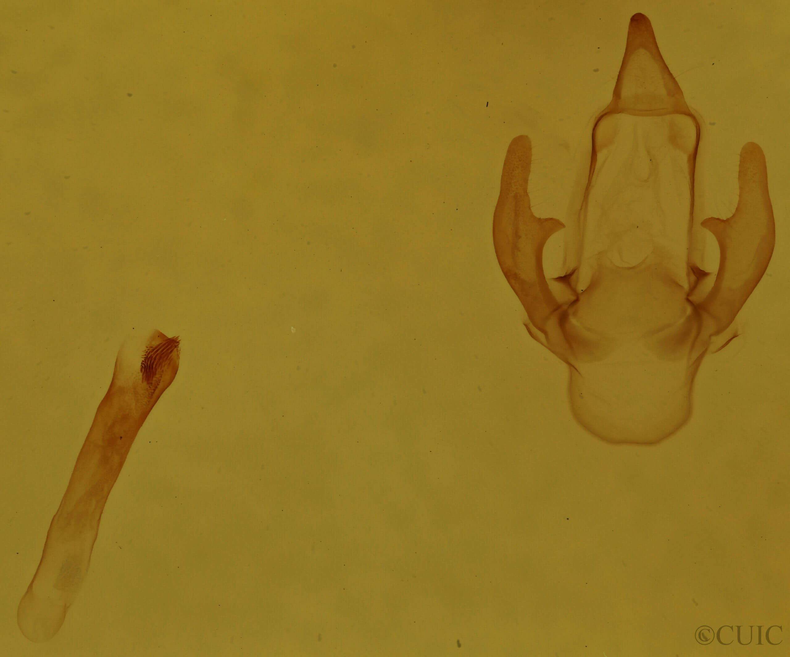 genitalia view of adult Hyphantria cunea