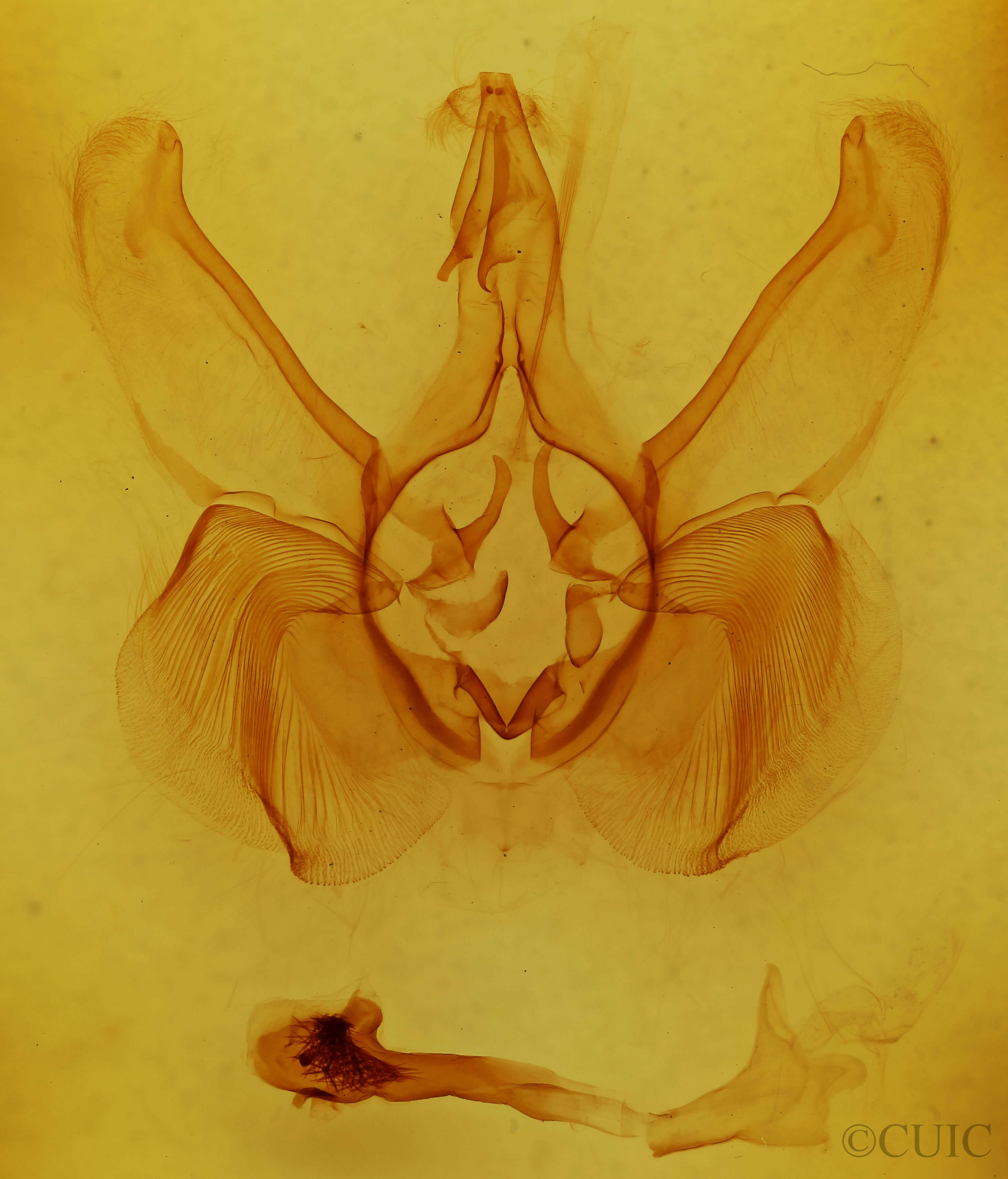 genitalia view of adult Lepasta bractea