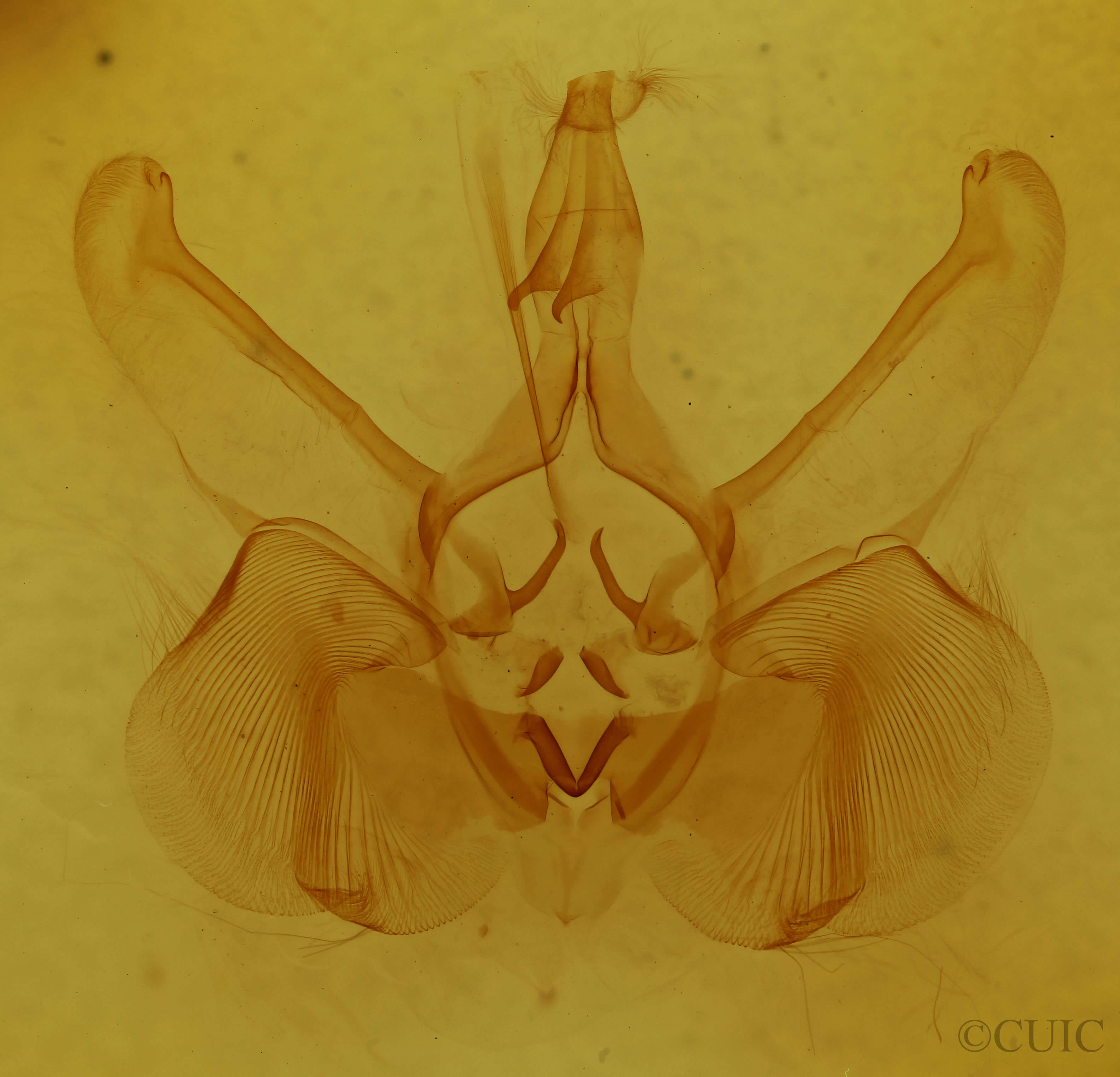 genitalia view of adult Lepasta bractea
