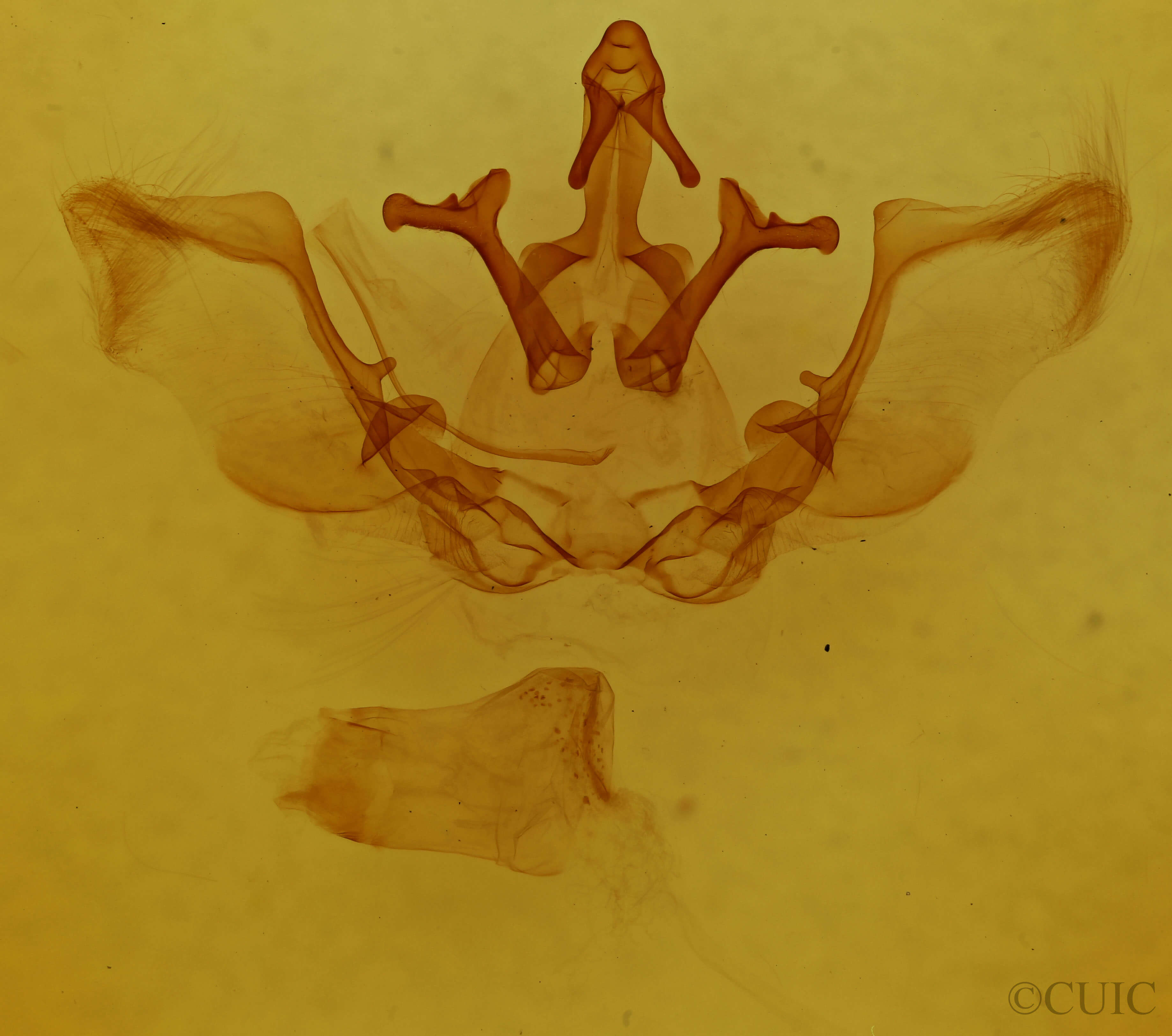 genitalia view of adult Lepasta conspicua