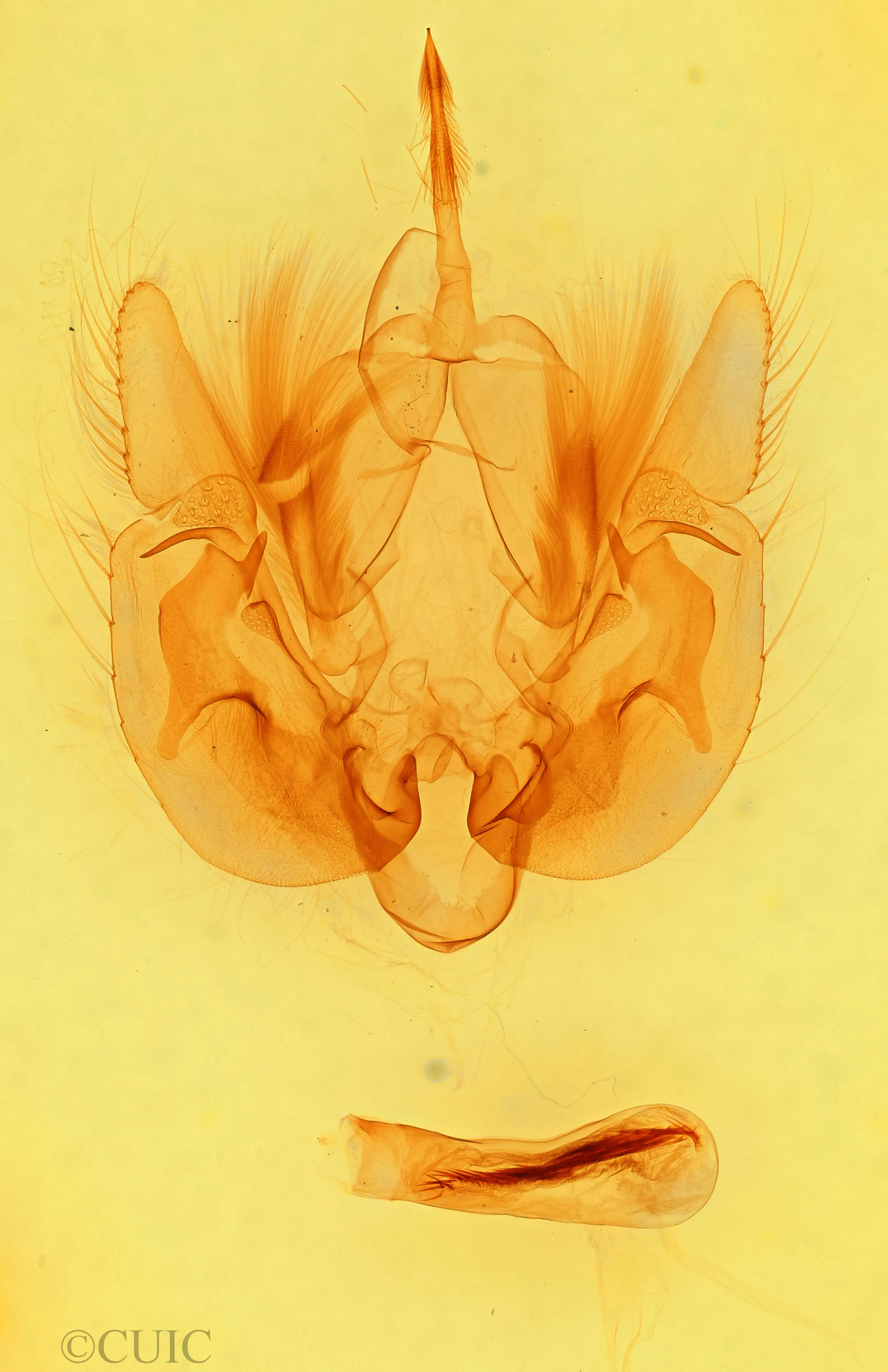 genitalia view of adult Leucania lapidaria