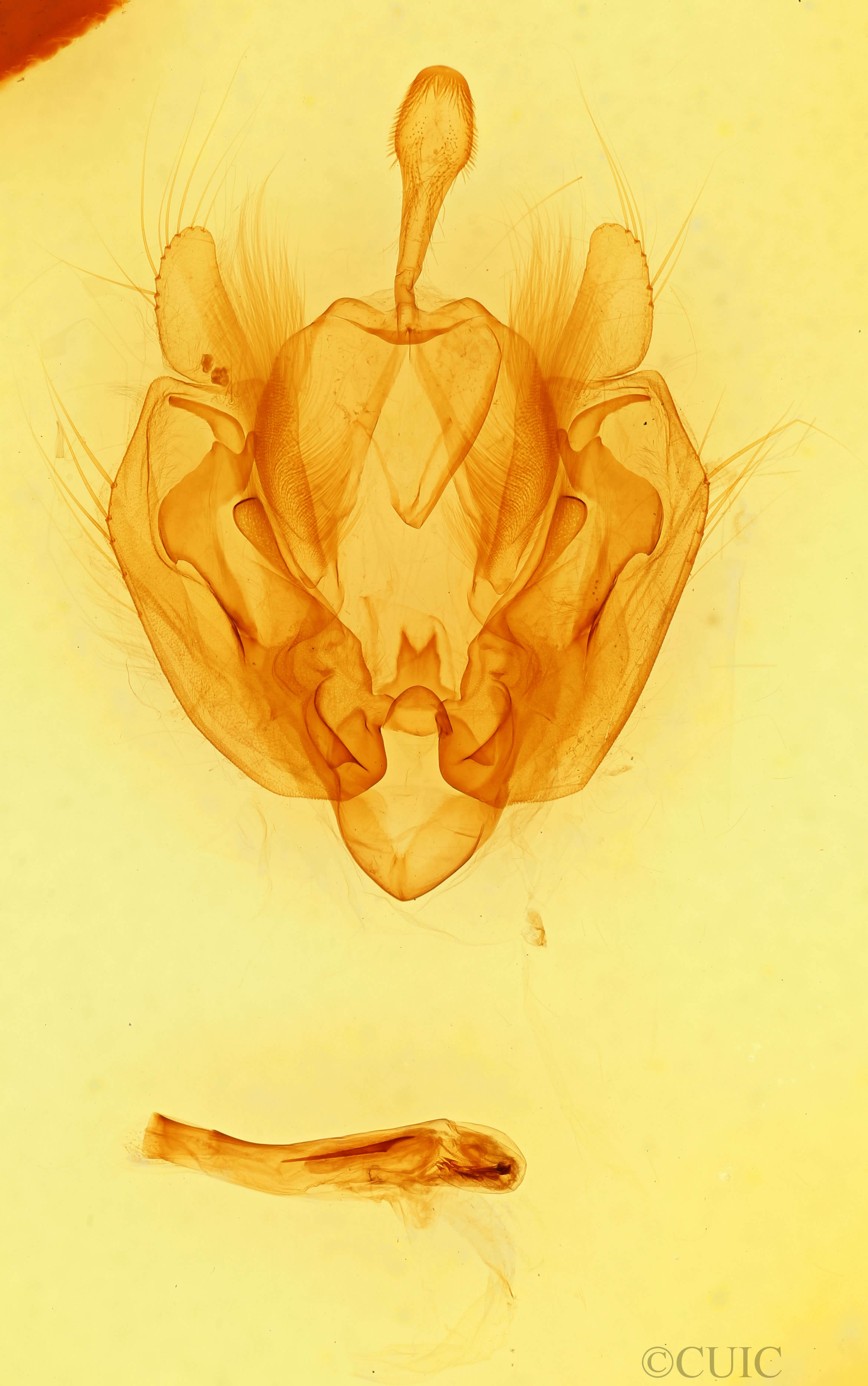 genitalia view of adult Leucania ursula