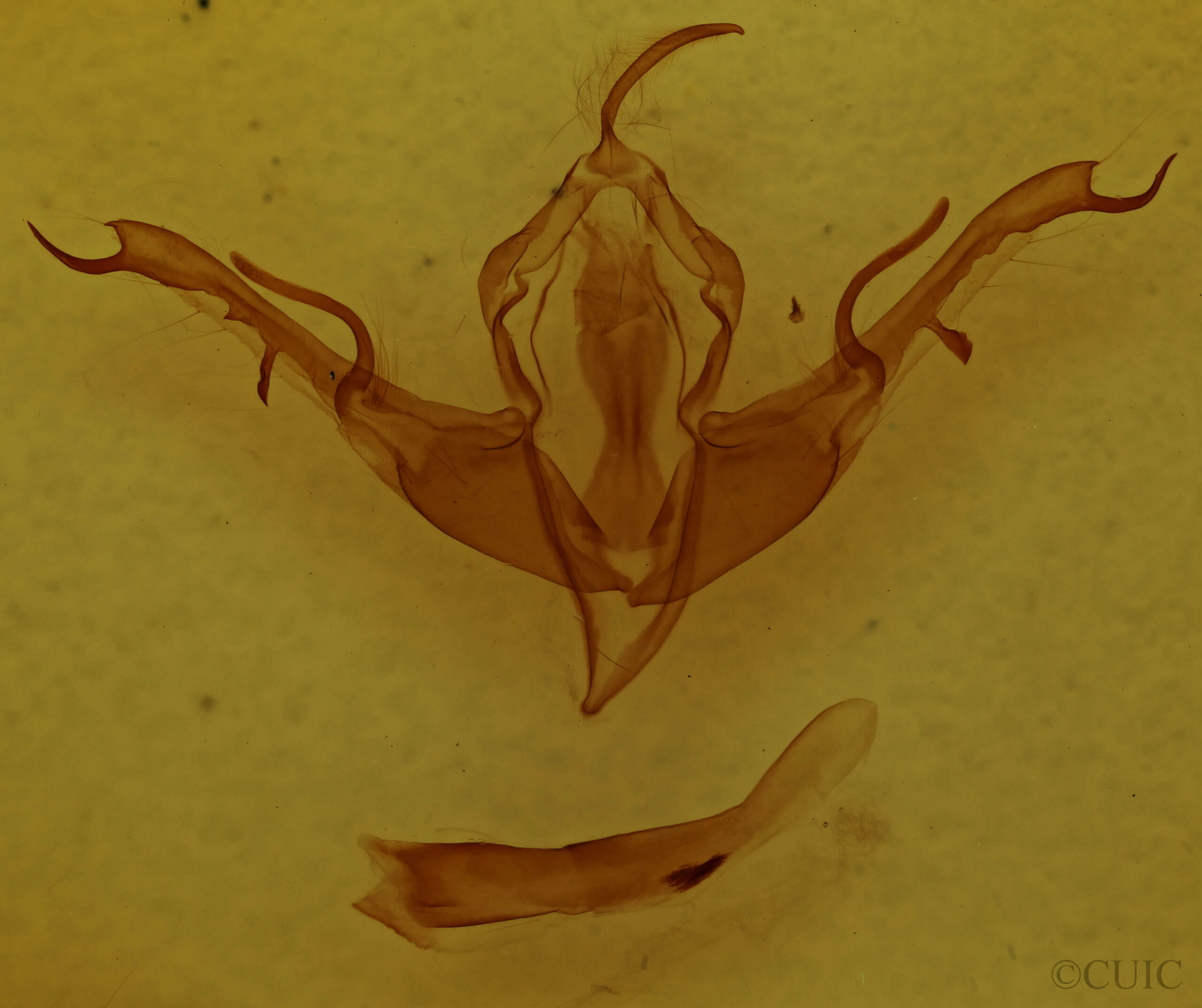 genitalia view of adult Lithophane baileyi