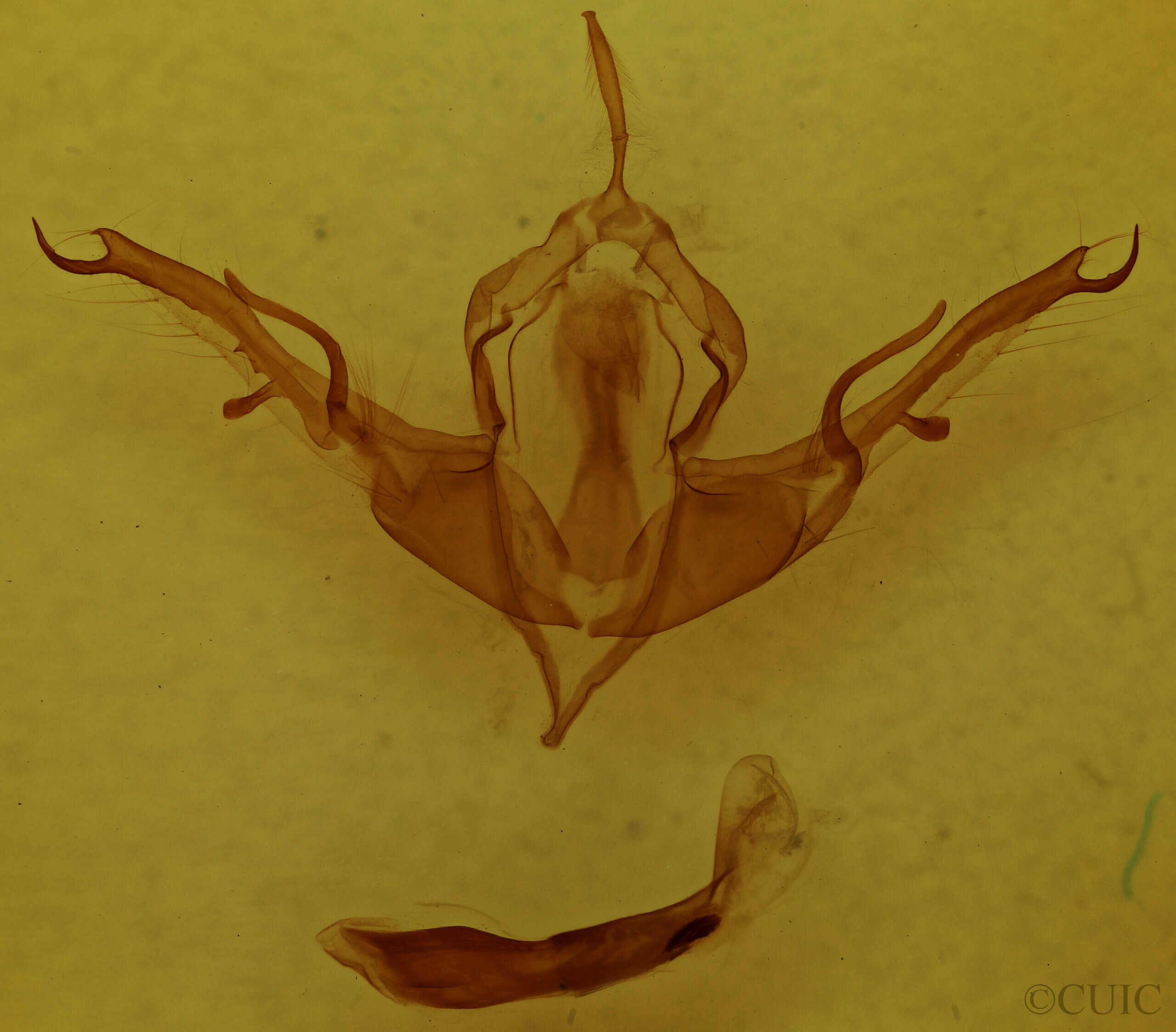 genitalia view of adult Lithophane baileyi