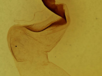 genitalia view of adult Lithophane baileyi