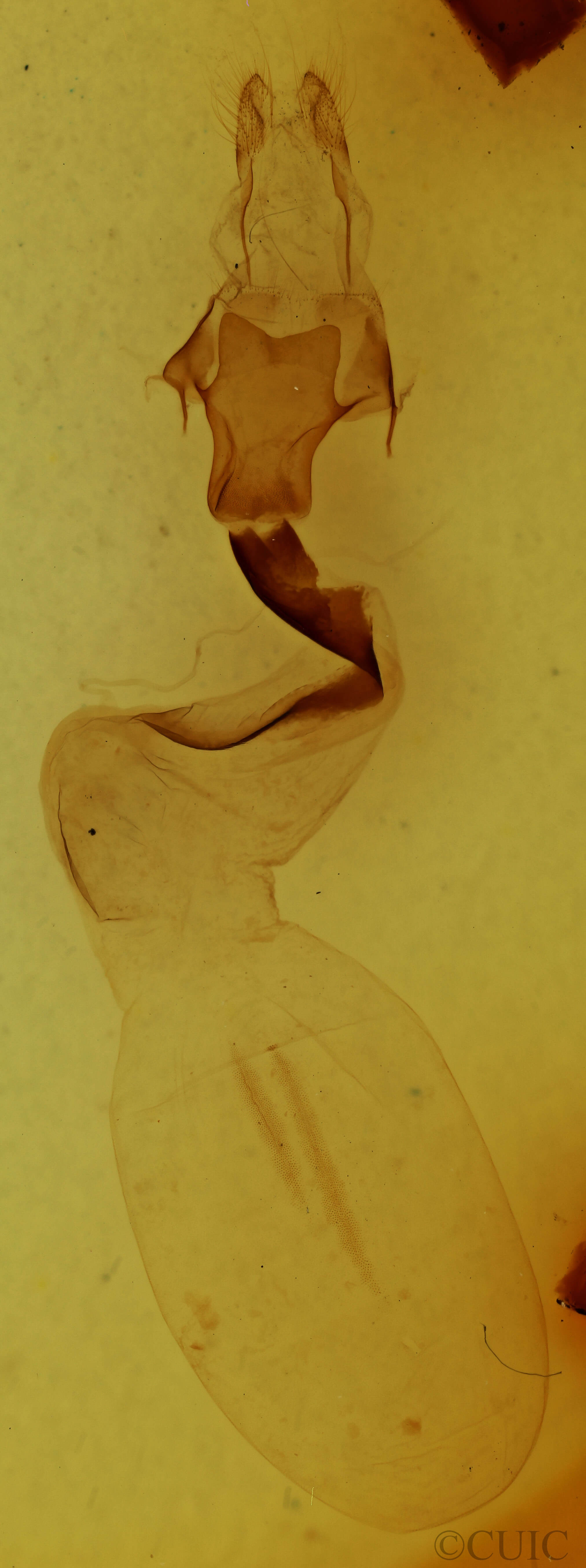 genitalia view of adult Lithophane baileyi