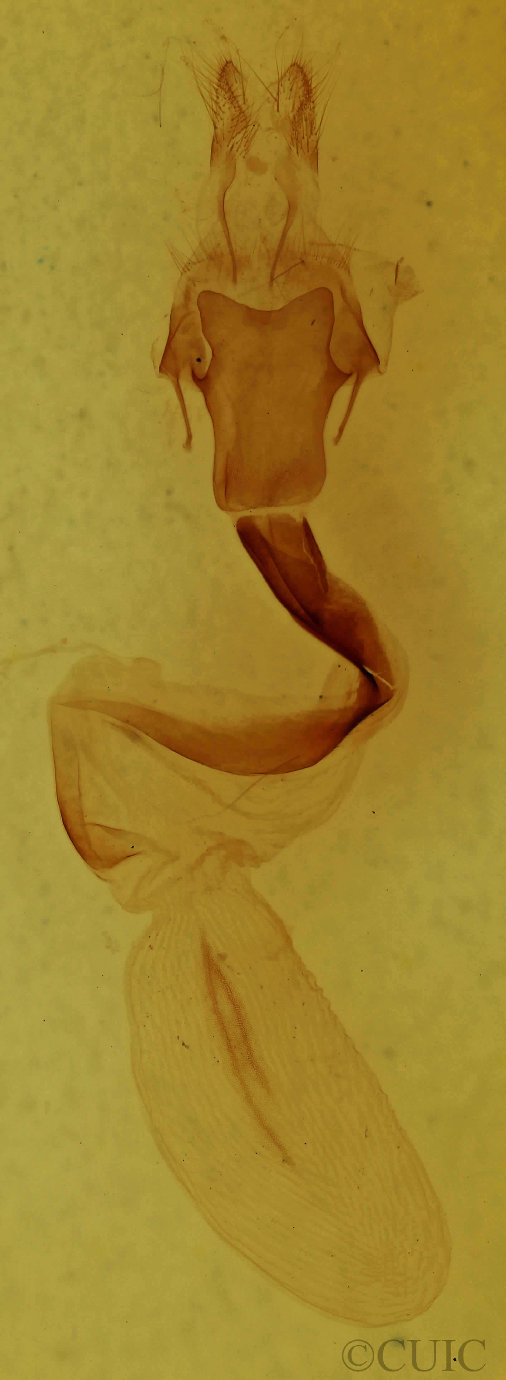 genitalia view of adult Lithophane baileyi