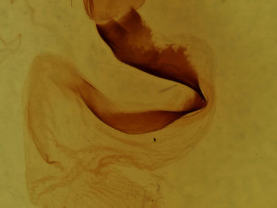 genitalia view of adult Lithophane baileyi