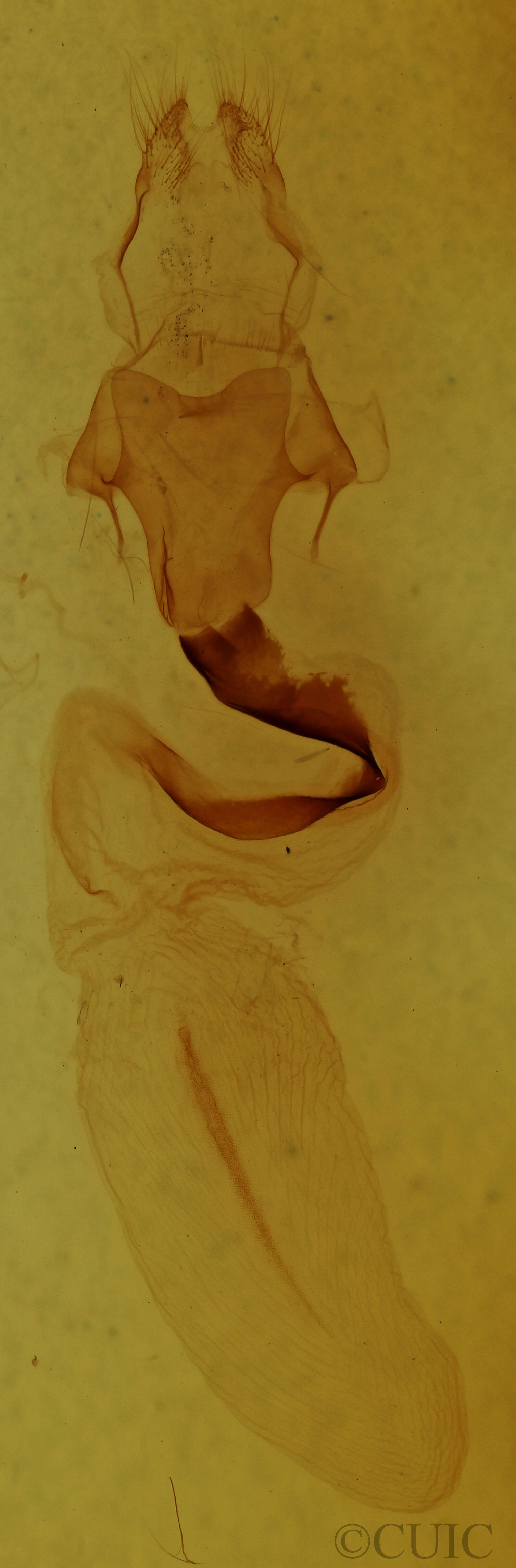 genitalia view of adult Lithophane baileyi