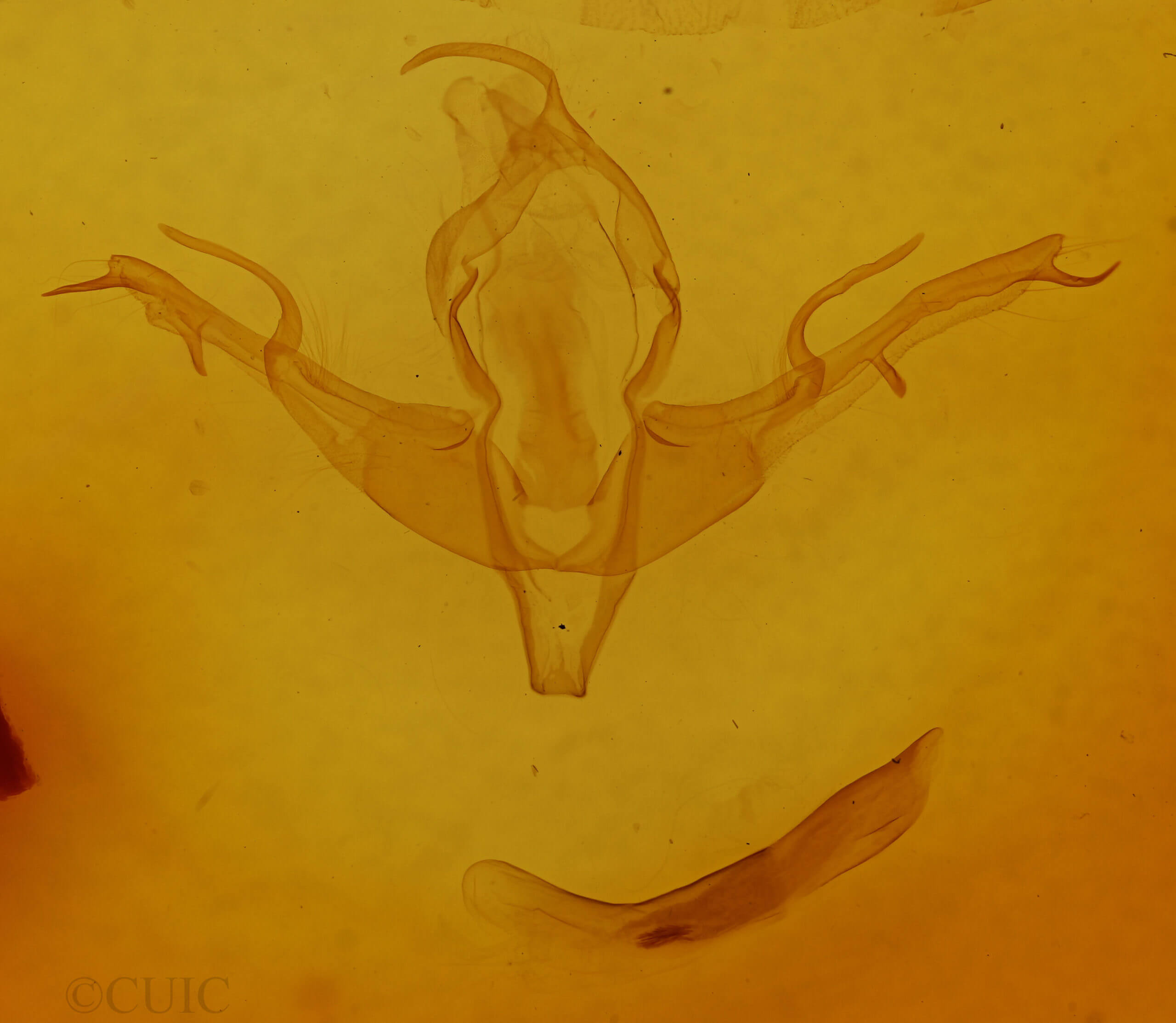 genitalia view of adult Lithophane baileyi