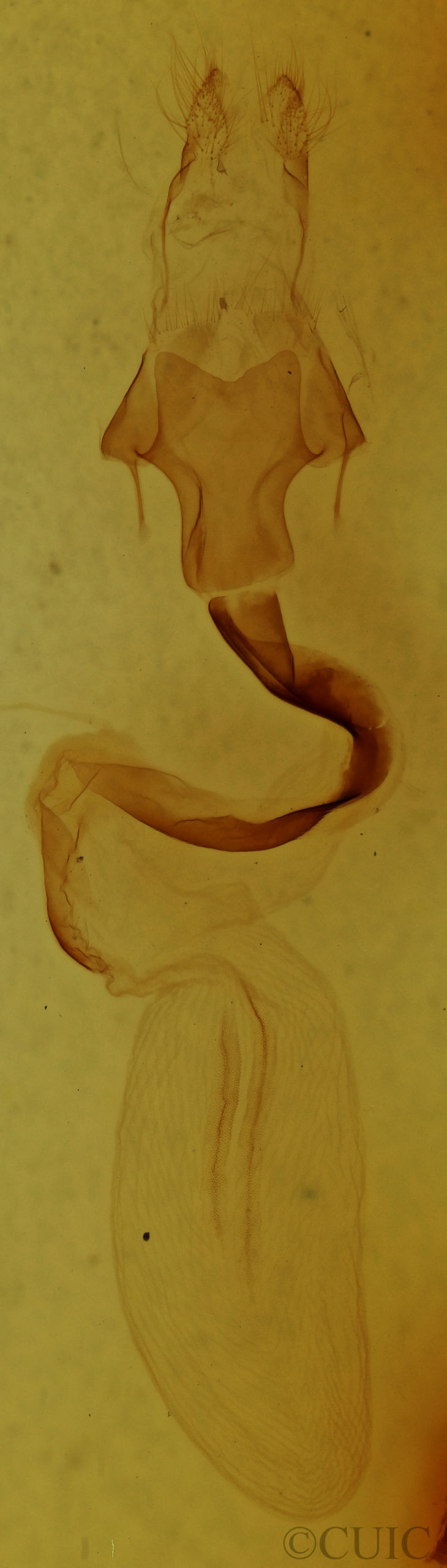 genitalia view of adult Lithophane baileyi