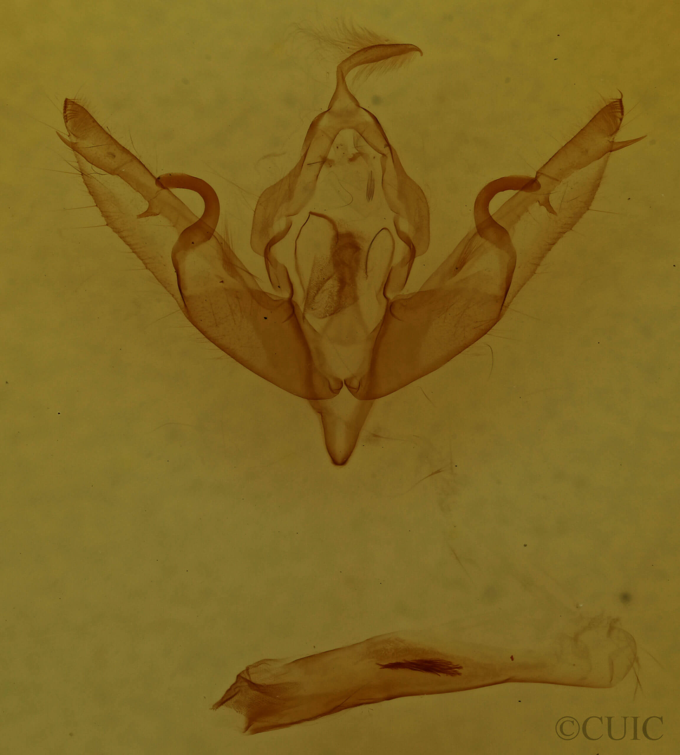 genitalia view of adult Lithophane oriunda