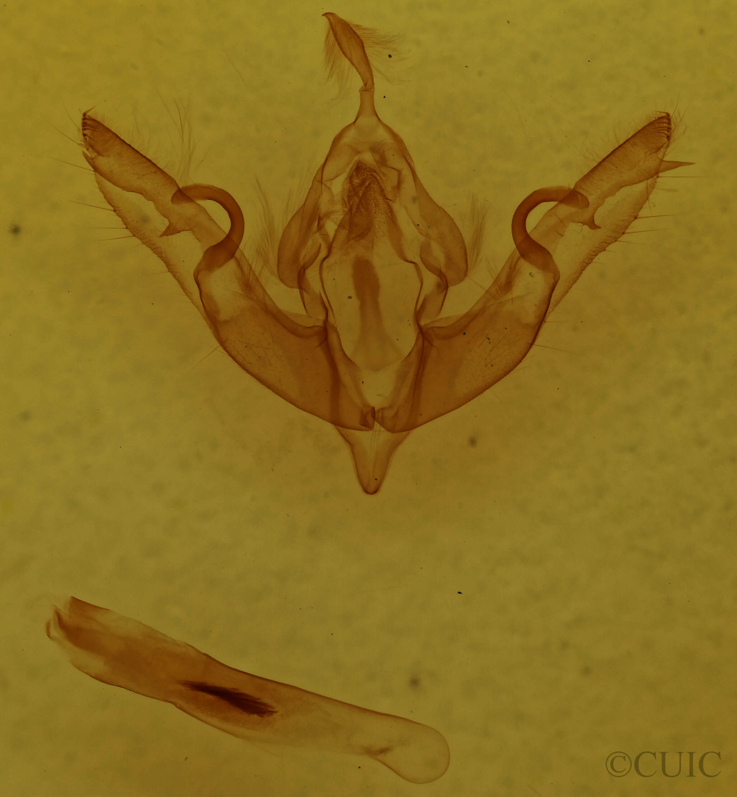 genitalia view of adult Lithophane oriunda
