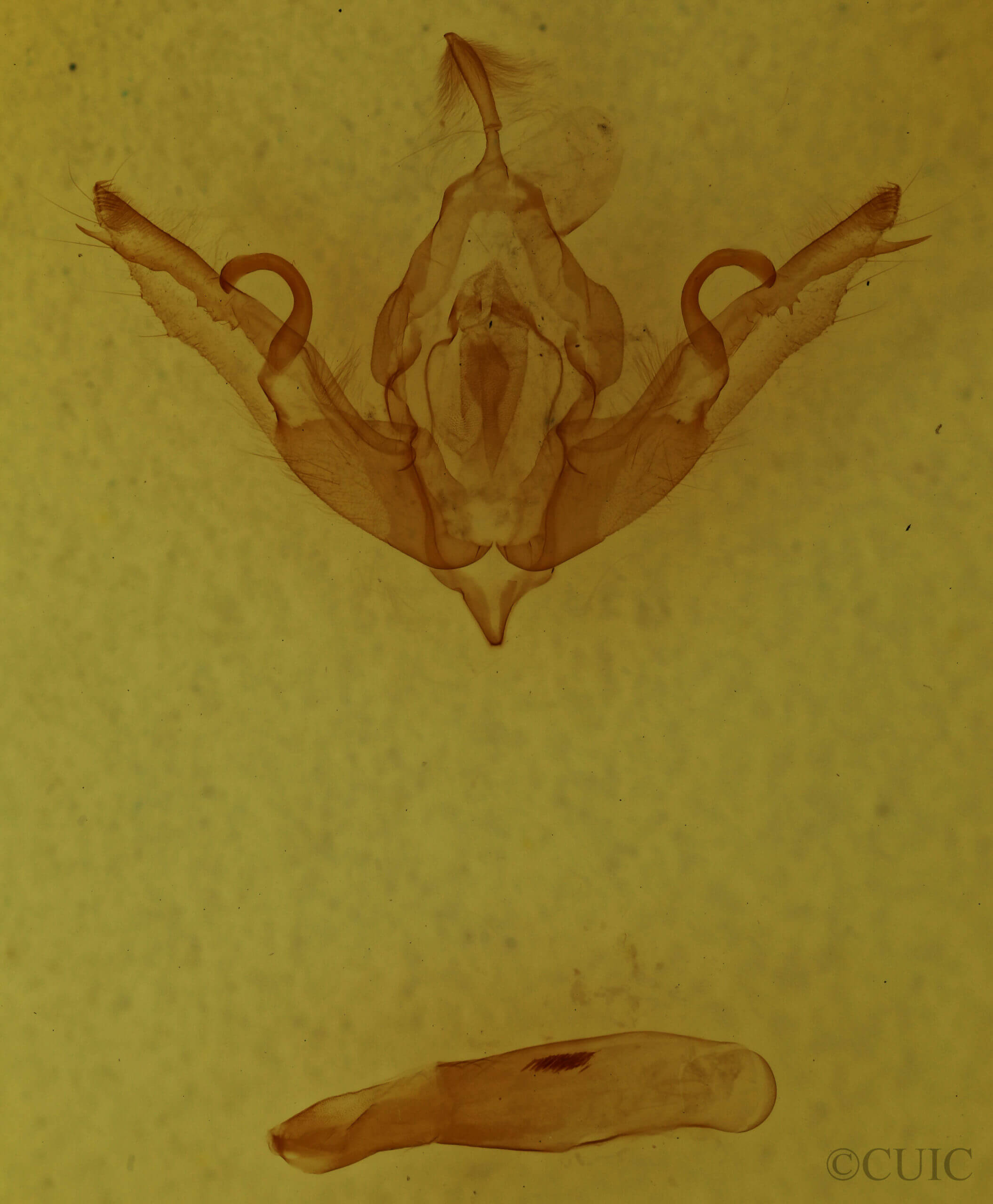 genitalia view of adult Lithophane patefacta