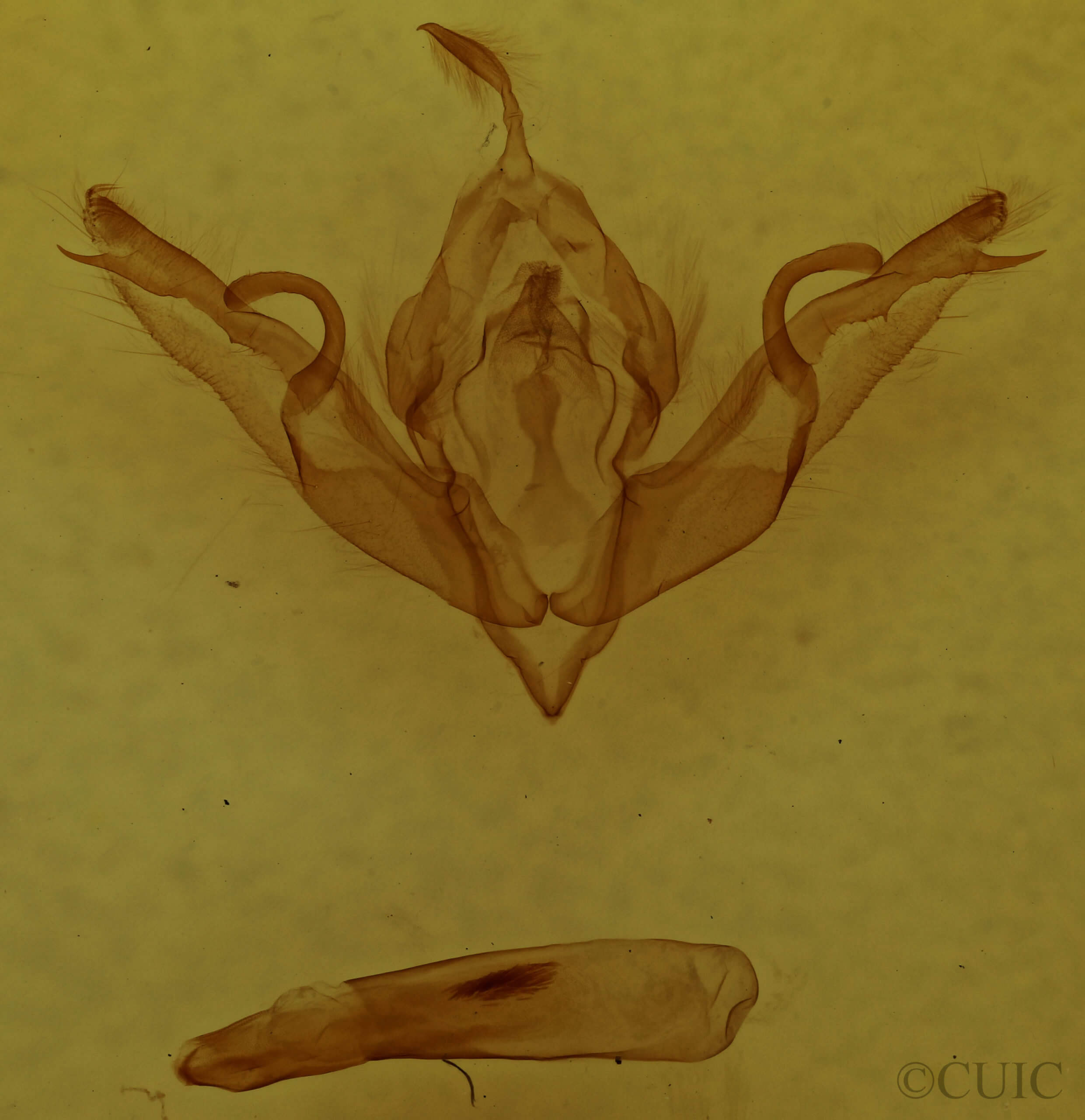 genitalia view of adult Lithophane patefacta