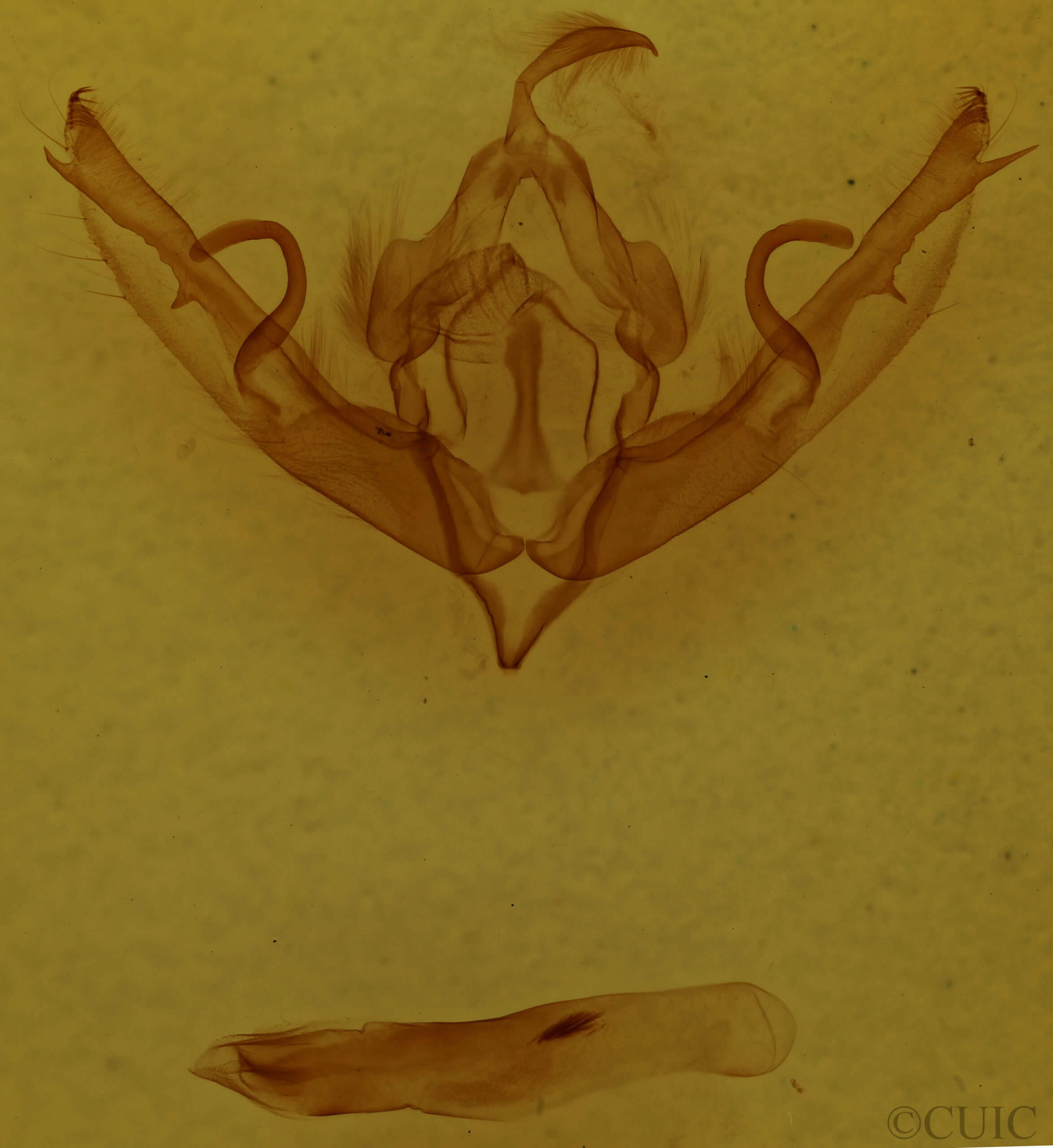 genitalia view of adult Lithophane petulca