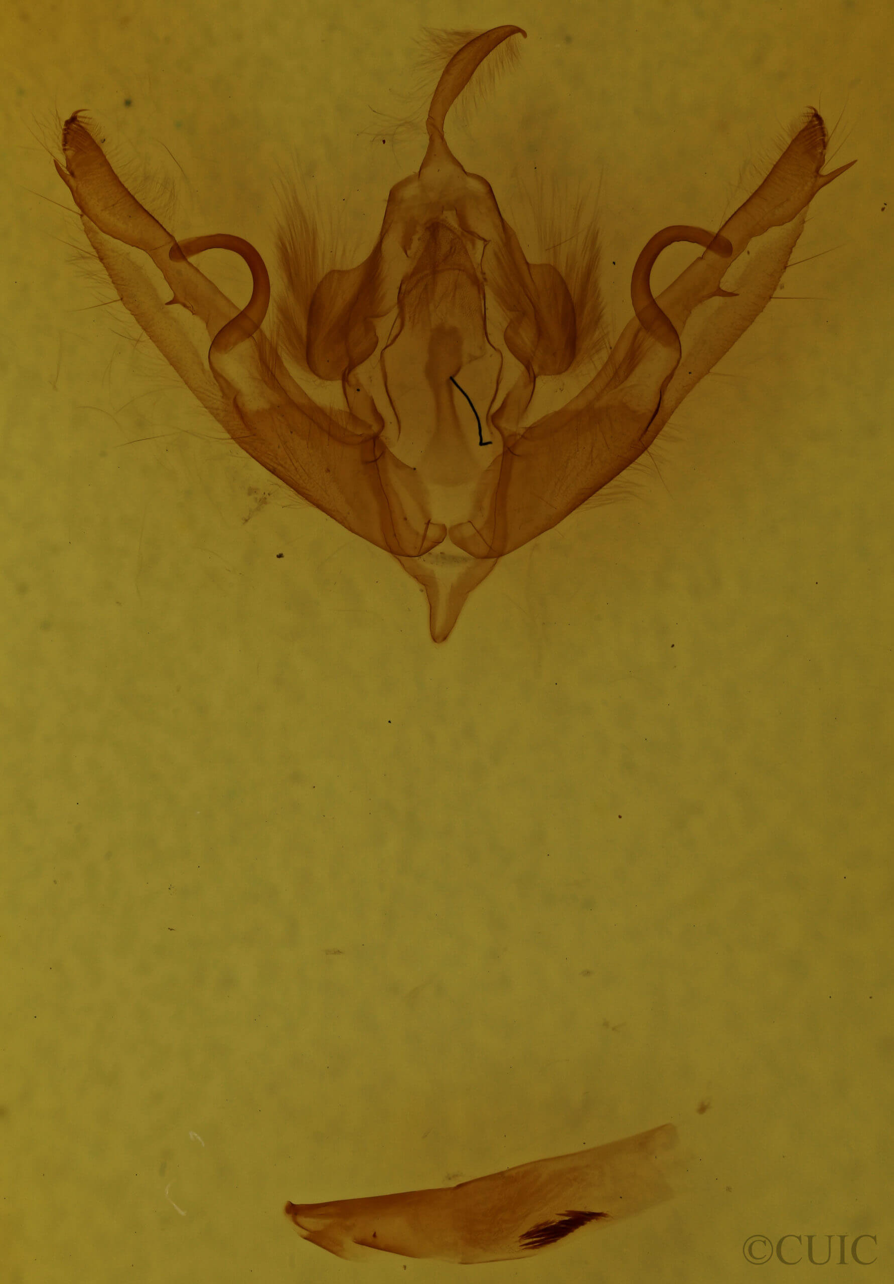 genitalia view of adult Lithophane petulca